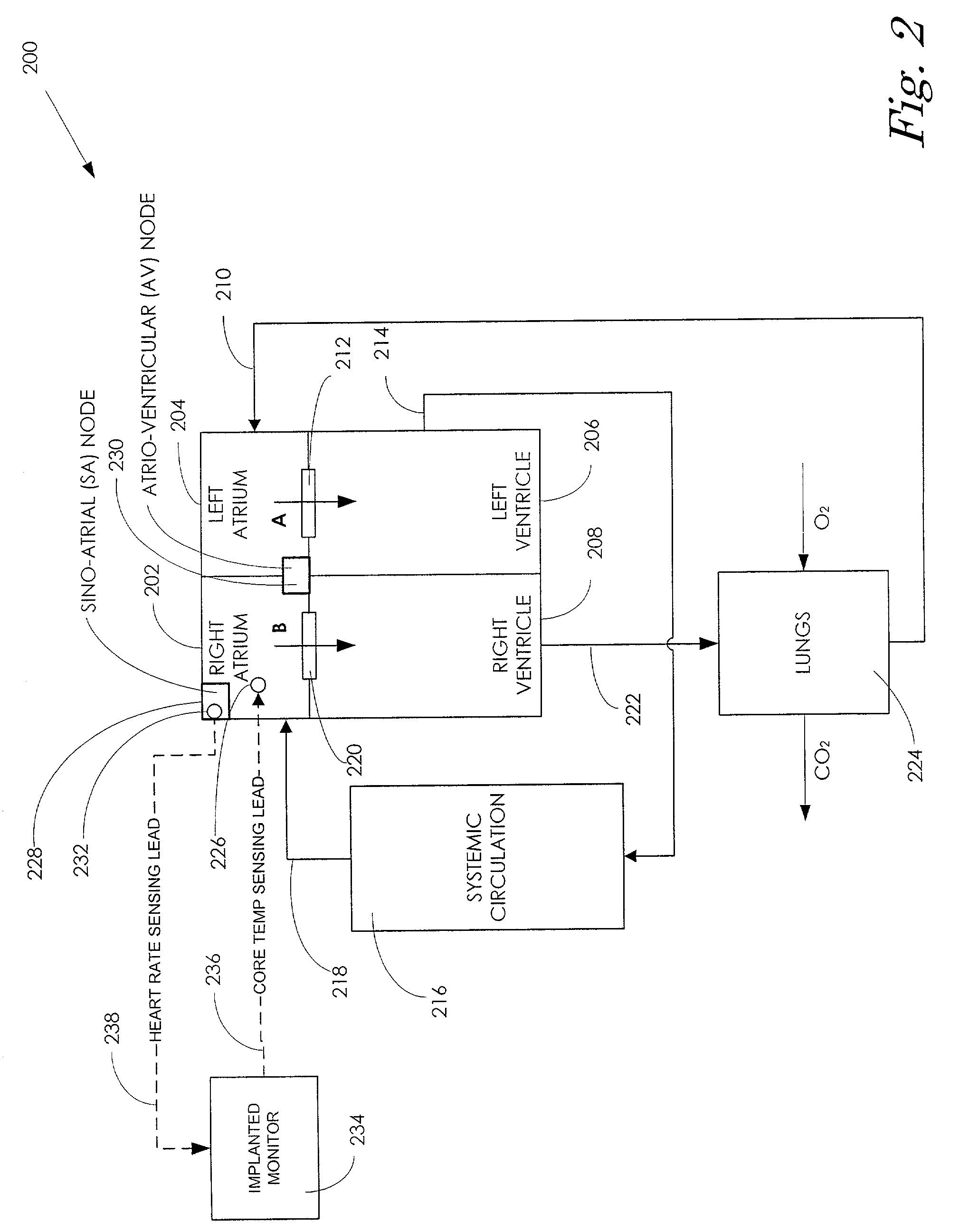 Core body temperature monitoring in heart failure patients