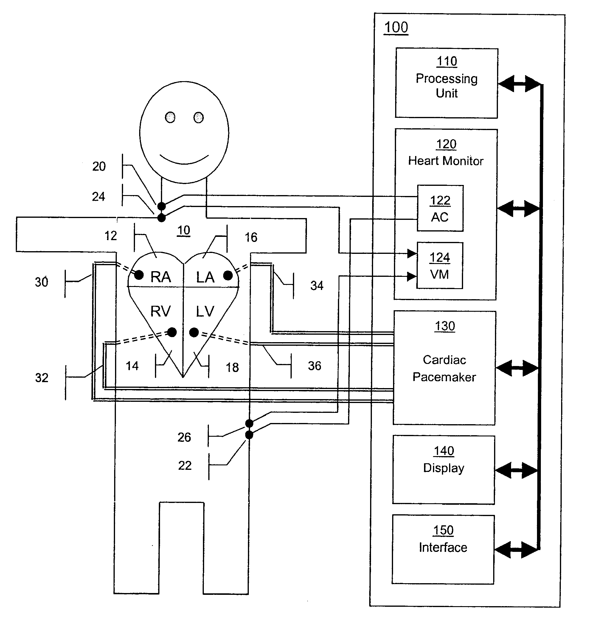 Method and apparatus for automatic determination of hemodynamically optimal cardiac pacing parameter values