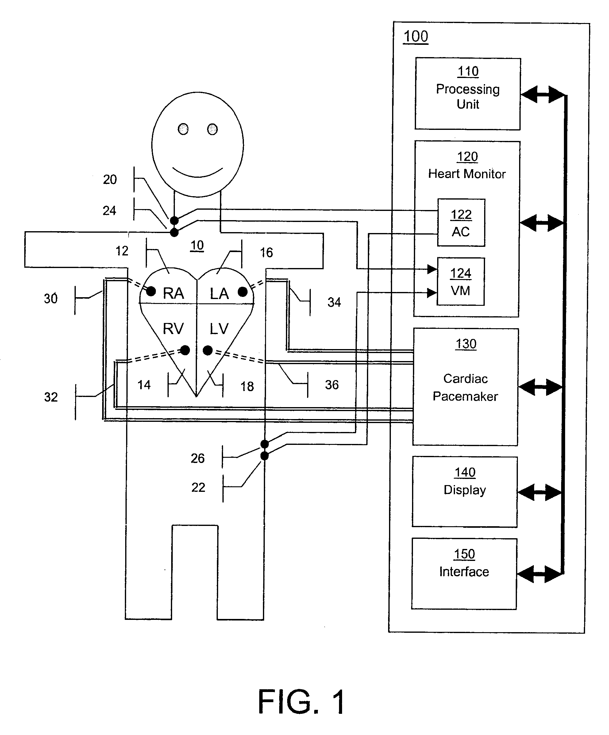 Method and apparatus for automatic determination of hemodynamically optimal cardiac pacing parameter values