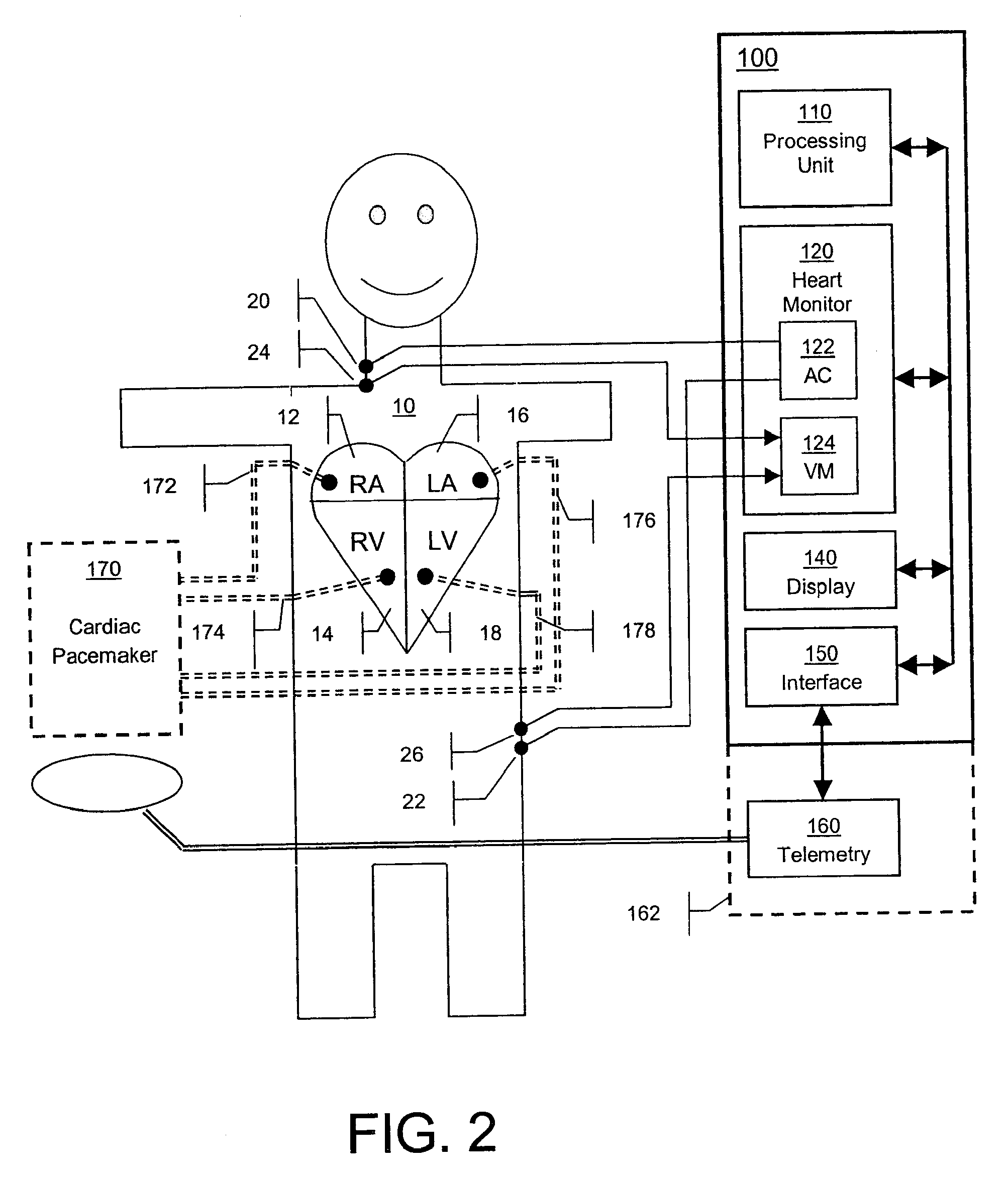 Method and apparatus for automatic determination of hemodynamically optimal cardiac pacing parameter values