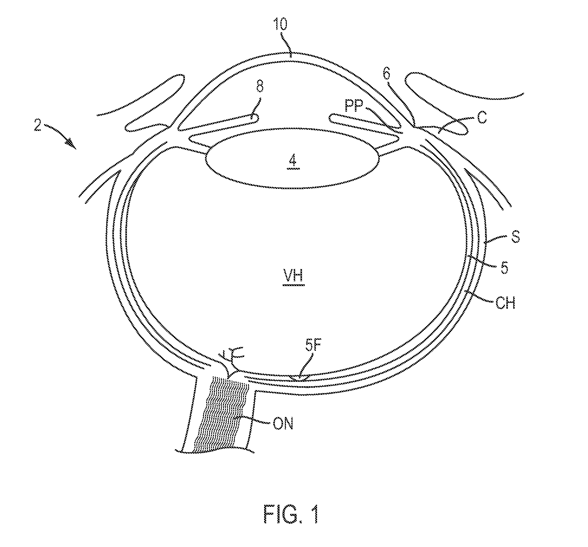 Contact lenses for diffractive correction