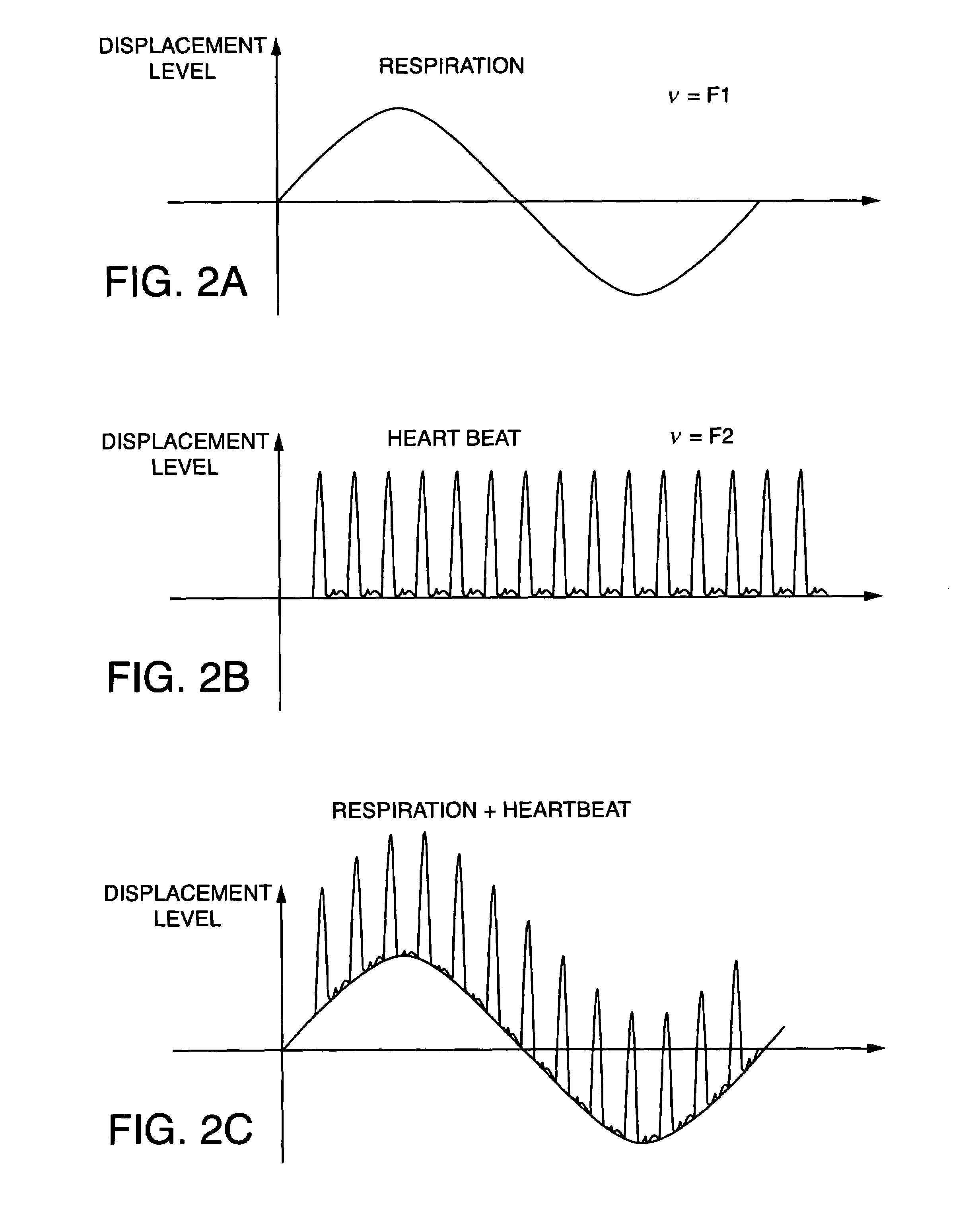 Apparatus and method for radiosurgery