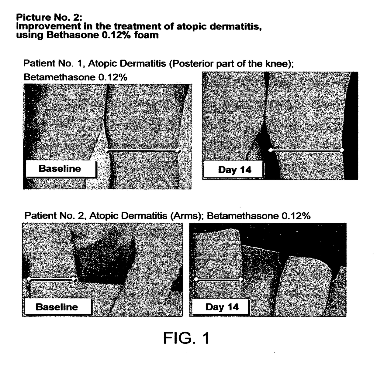 Cosmetic and pharmaceutical foam