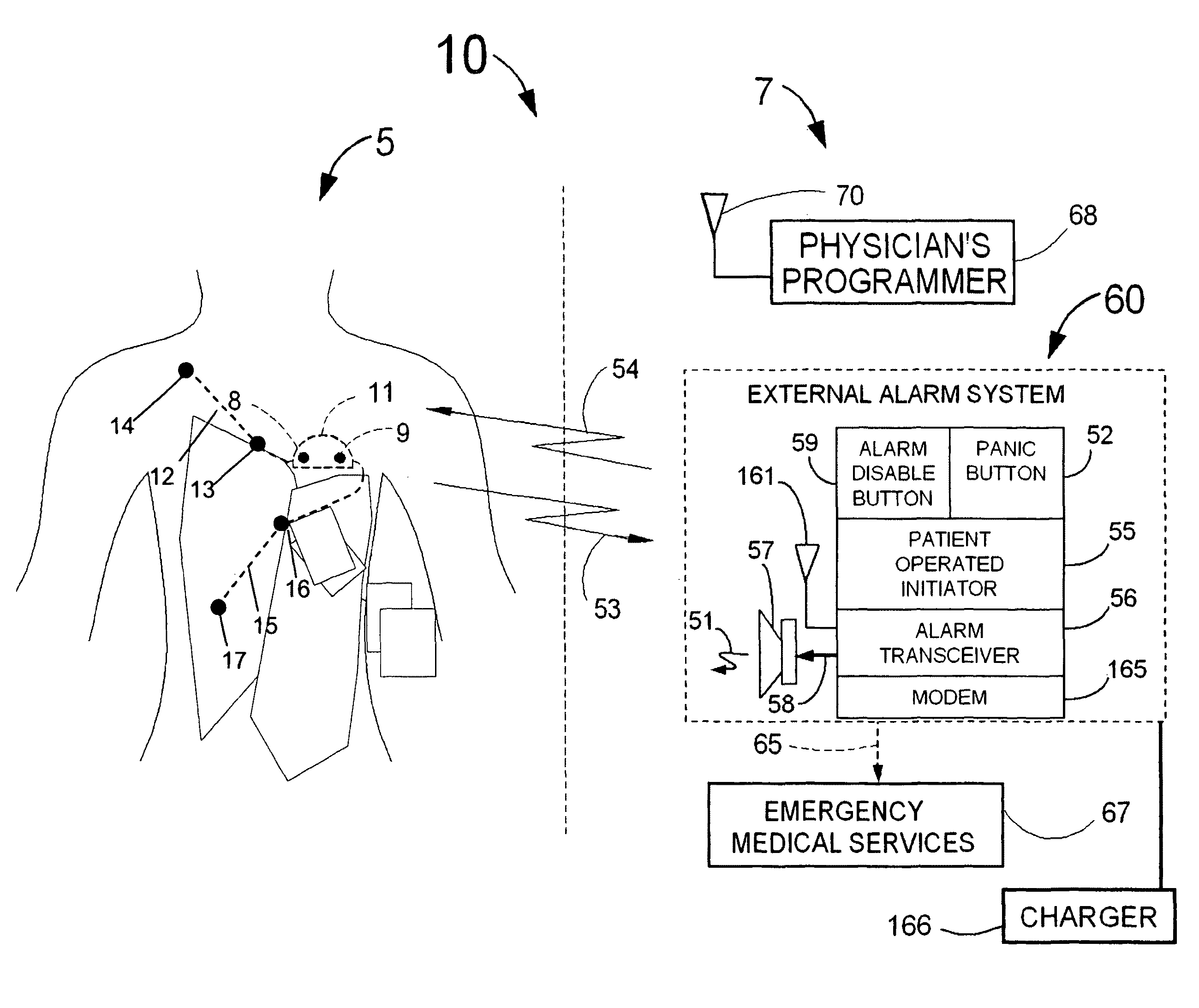 Heart rate correction system and methods for the detection of cardiac events