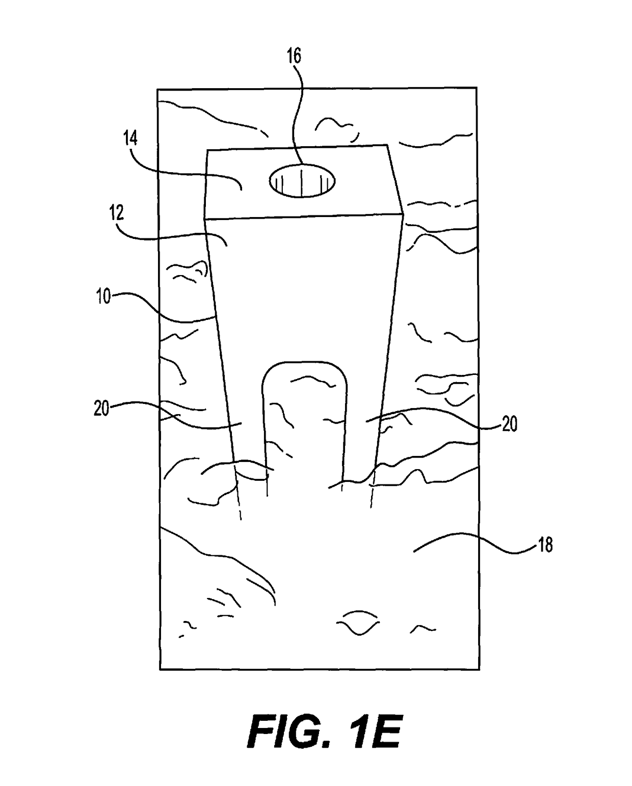 Devices and methods for temporary mounting of parts to bone