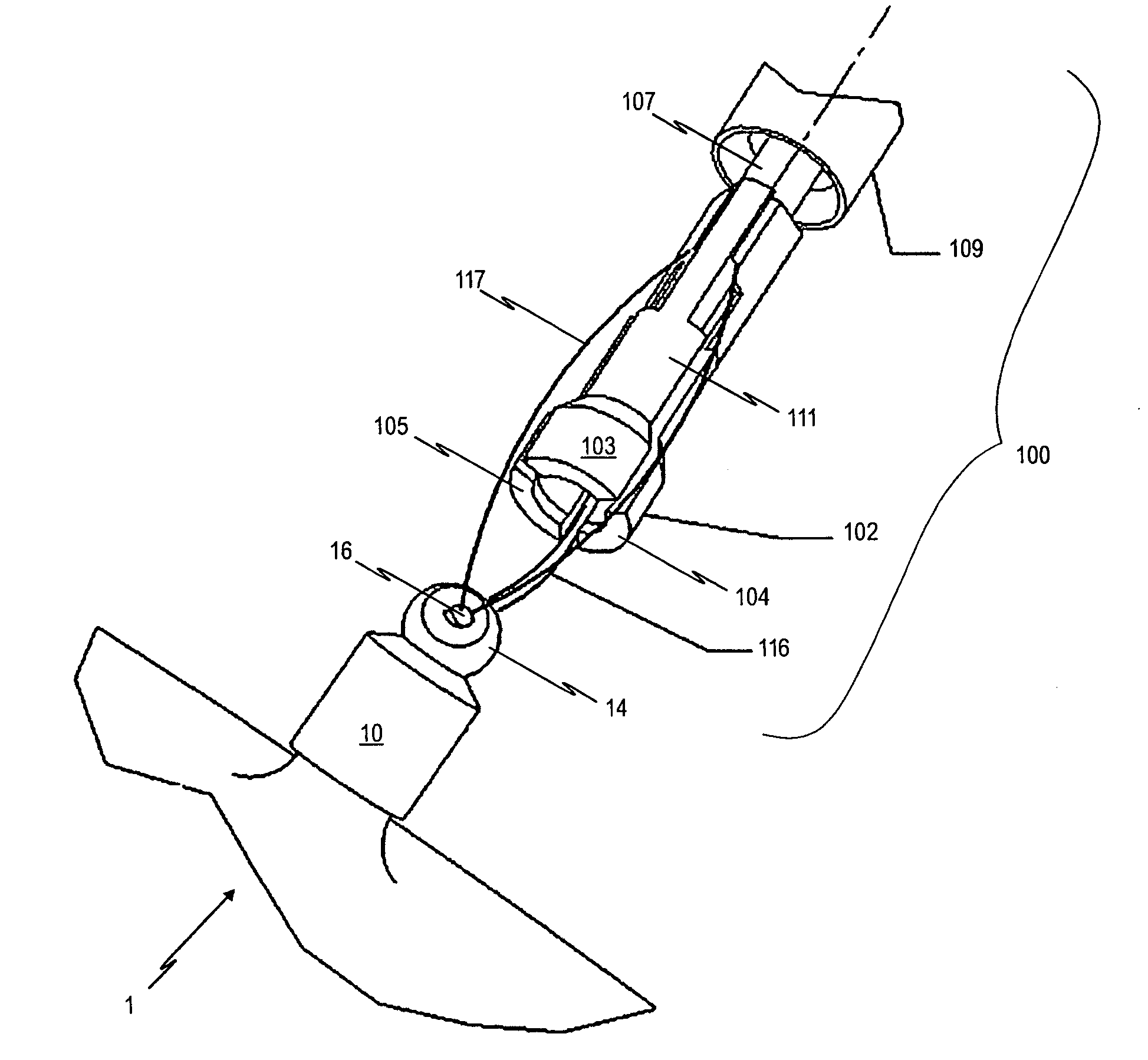 Occlusion device and surgical instrument and method for its implantation/explantation