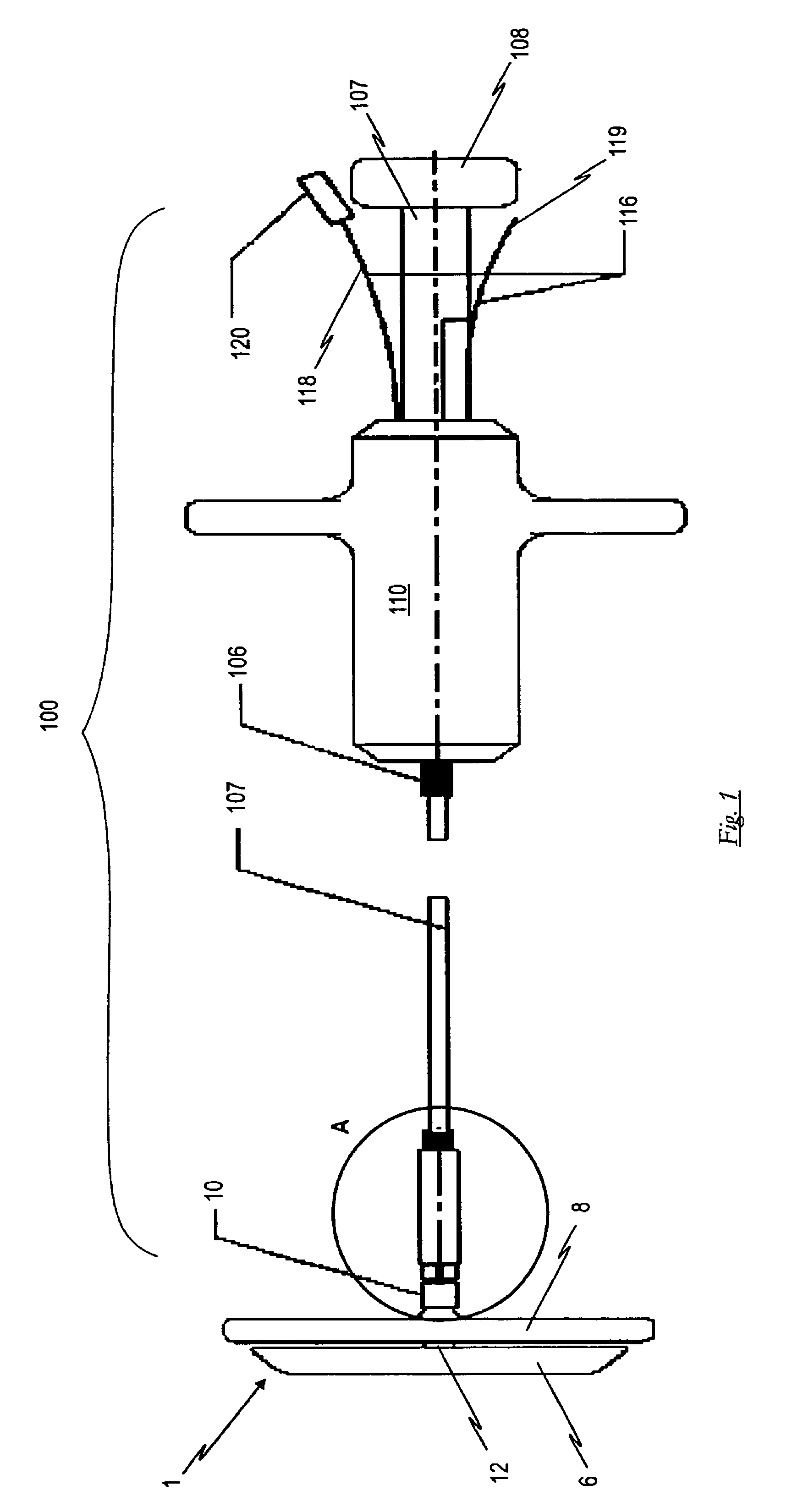 Occlusion device and surgical instrument and method for its implantation/explantation