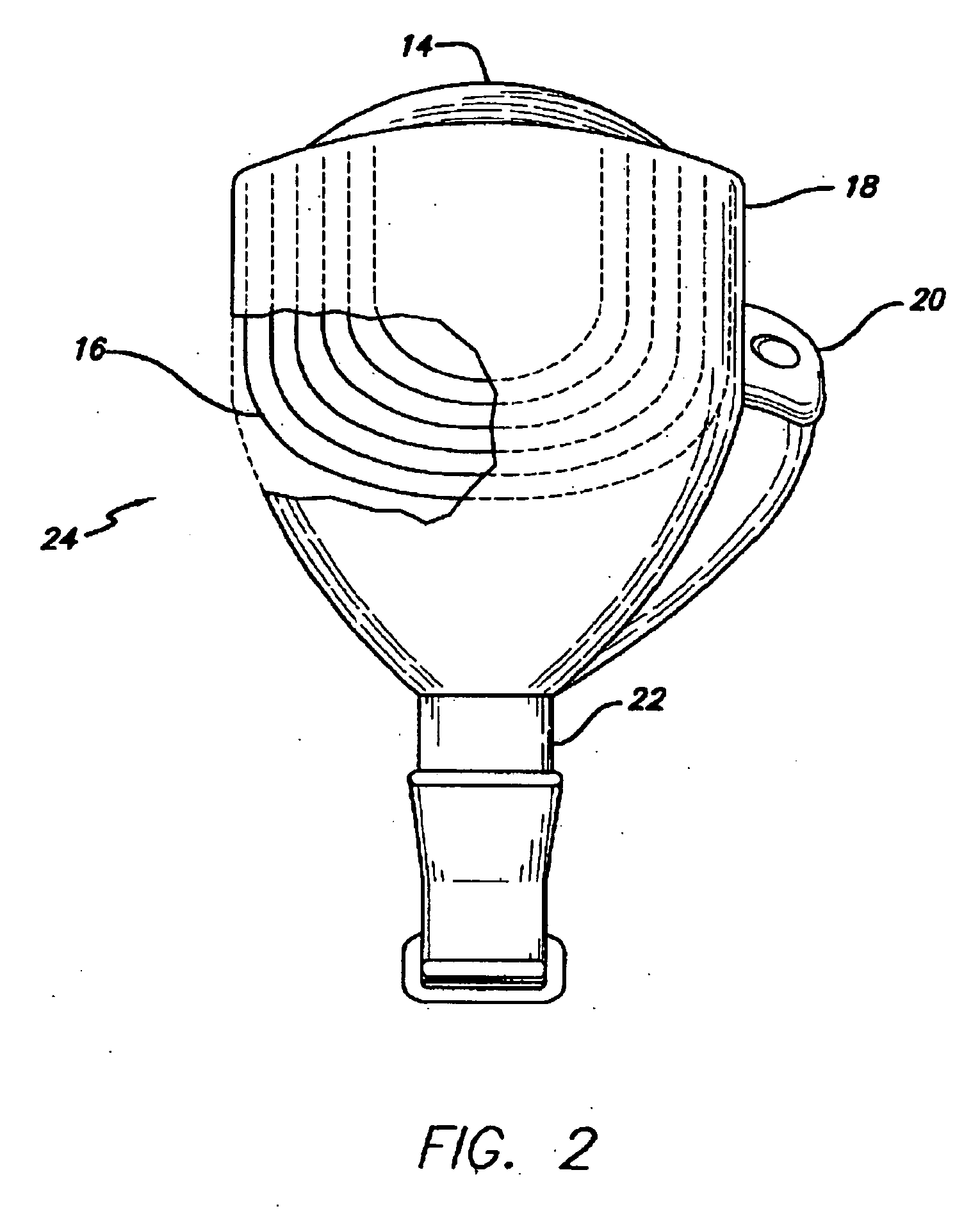 Retinal prosthesis with a new configuration