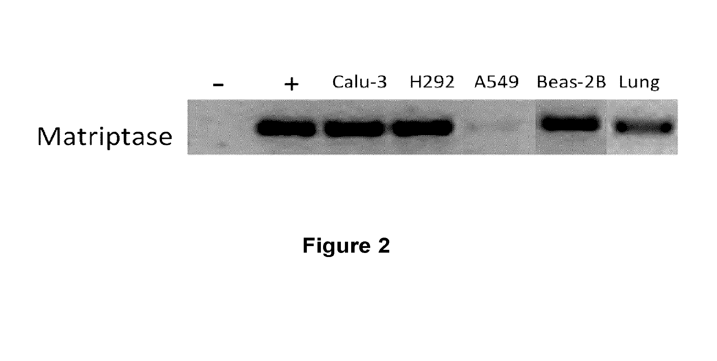 Matriptase inhibitors and uses thereof against orthomyxoviridae infections