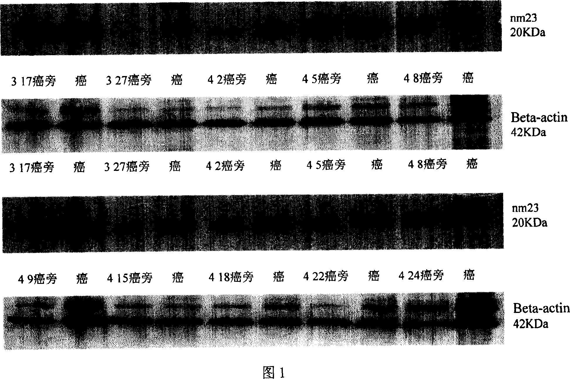 Application of nucleoside diphosphate kinase A