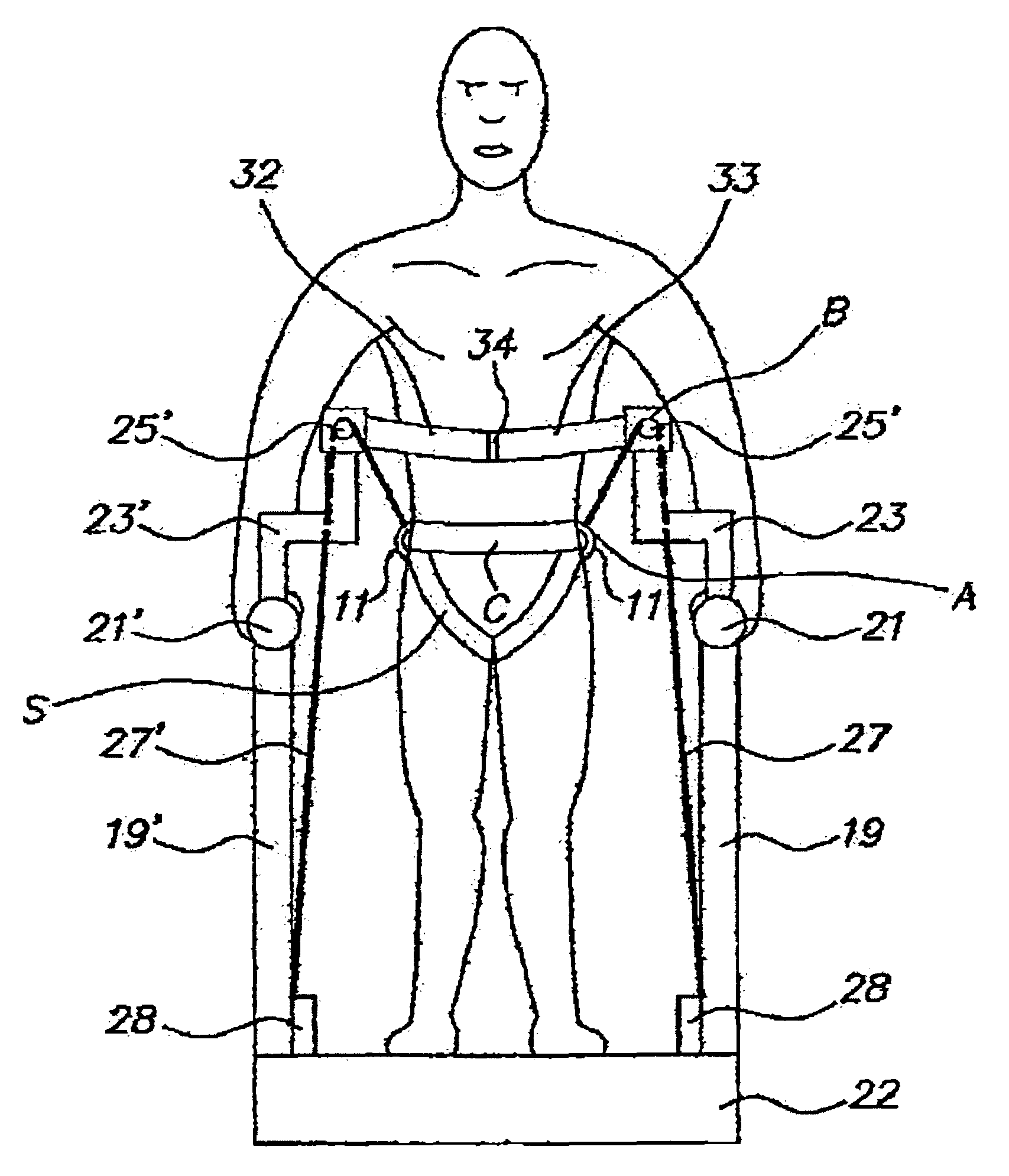 Device for the reeducation of motory deficiencies, particularly deficiencies when walking, in patients