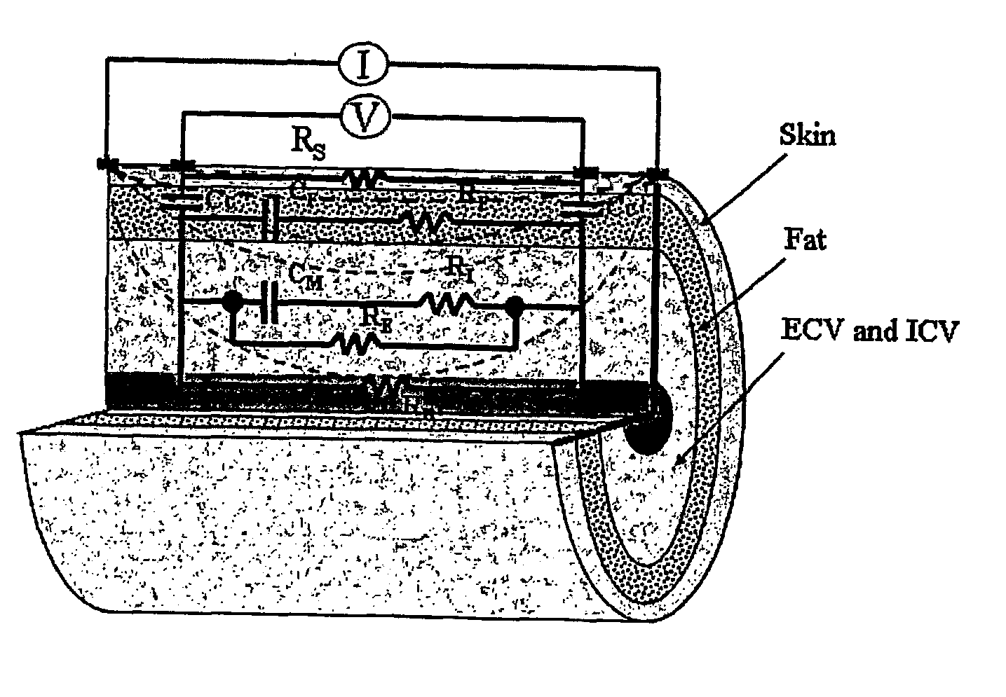 Bioimpedance methods and apparatus