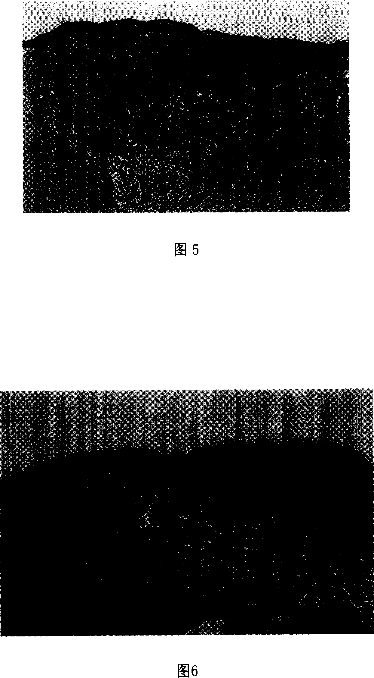 Composition and application of novel medicine package for preventing and treating women's cervical virus infection