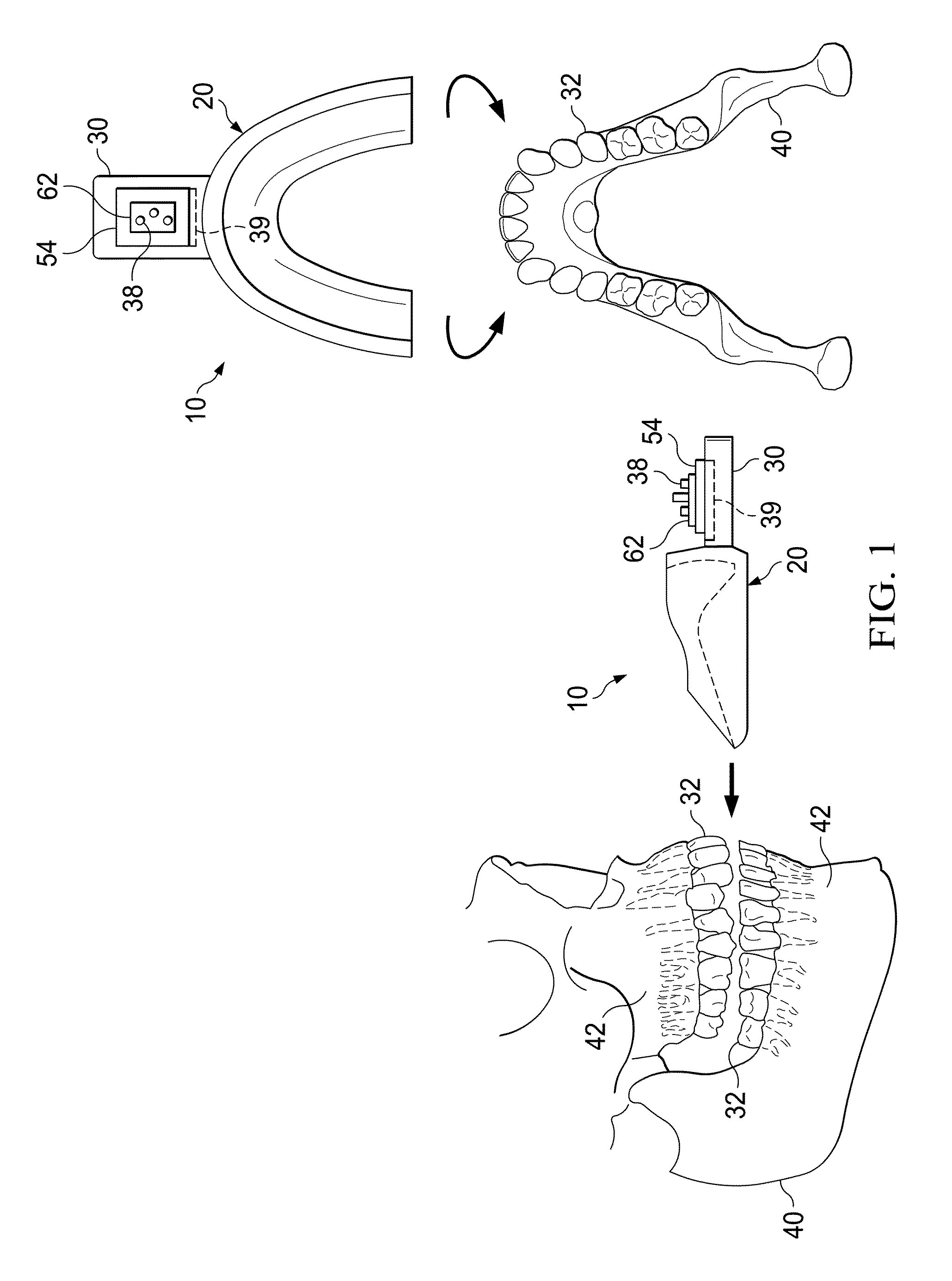 Vibrating orthodontic remodelling device