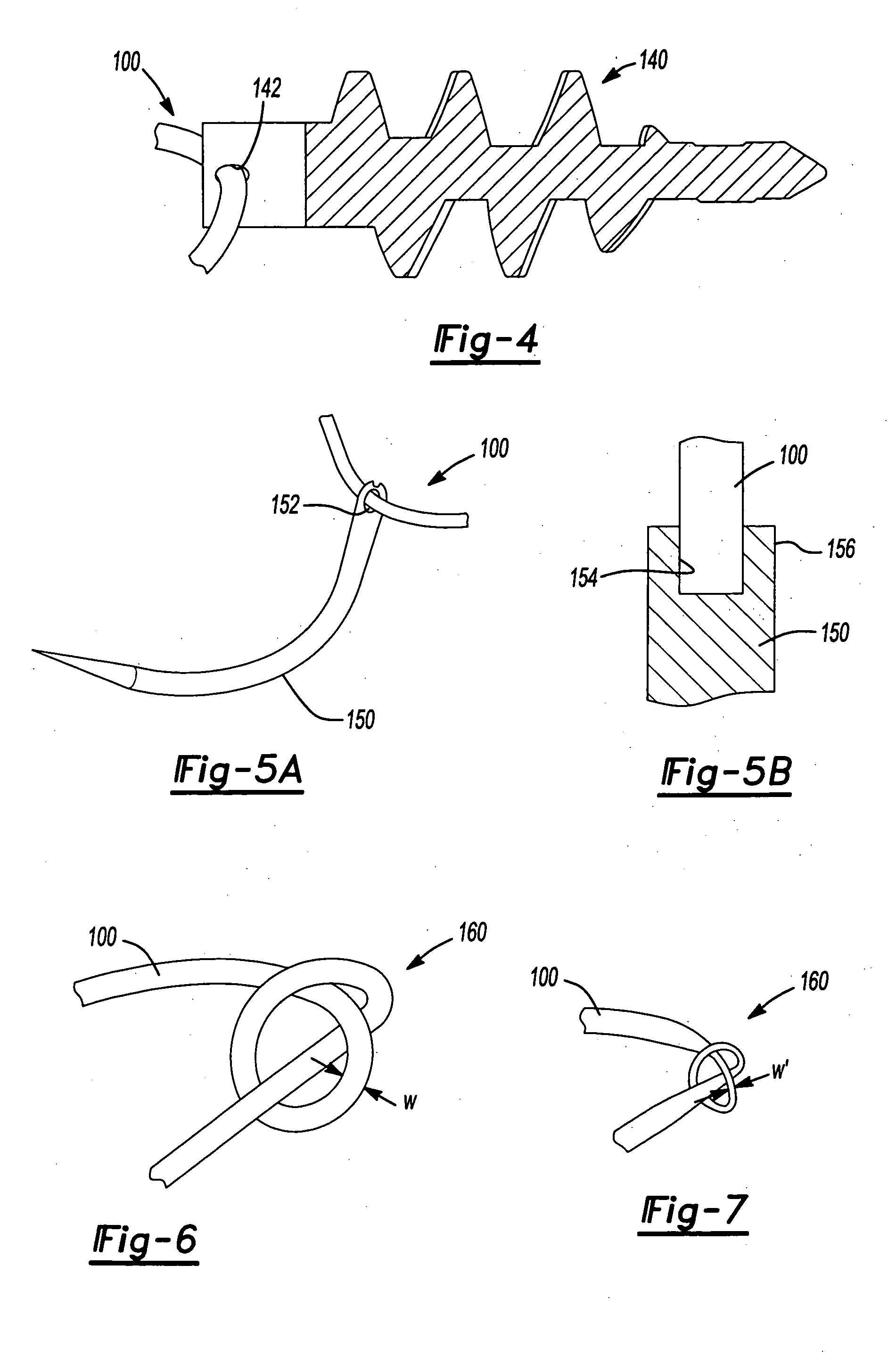 Braided suture