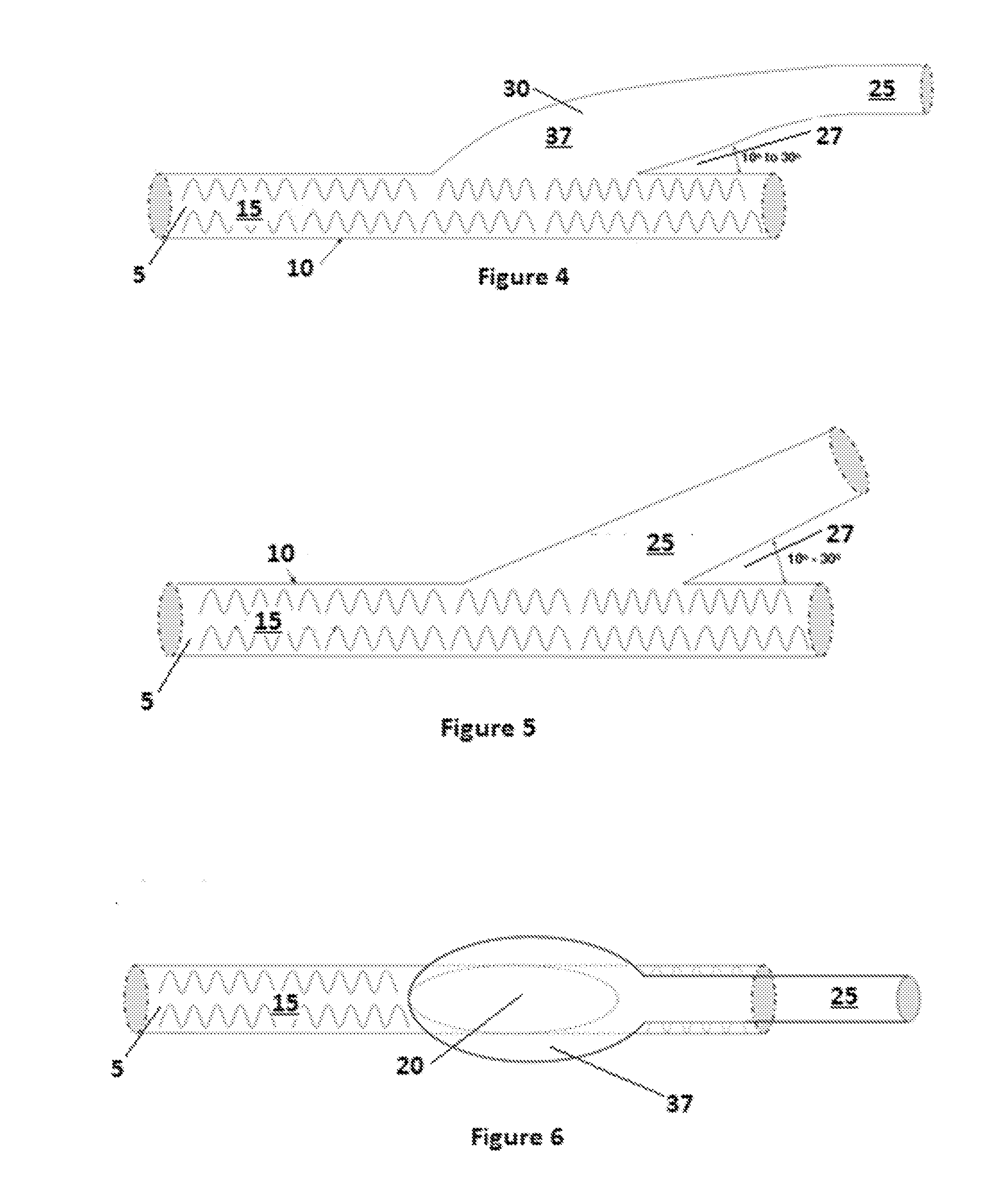 Device and method to prevent or treat outflow vein stenosis of an arteriovenous fistula constructed with a synthetic vascular graft