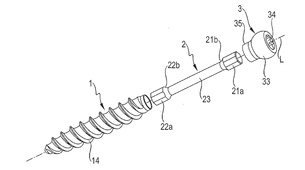 Dynamic bone anchor and method of manufacturing the same