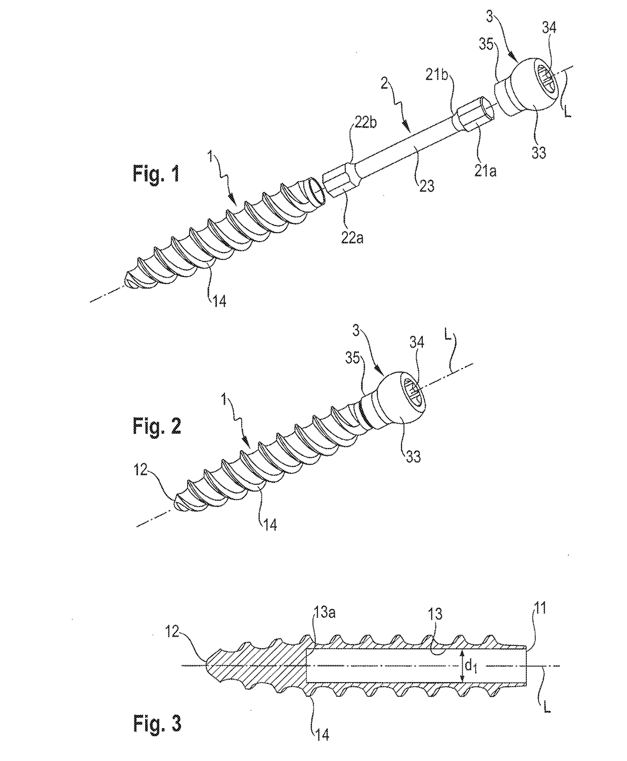 Dynamic bone anchor and method of manufacturing the same