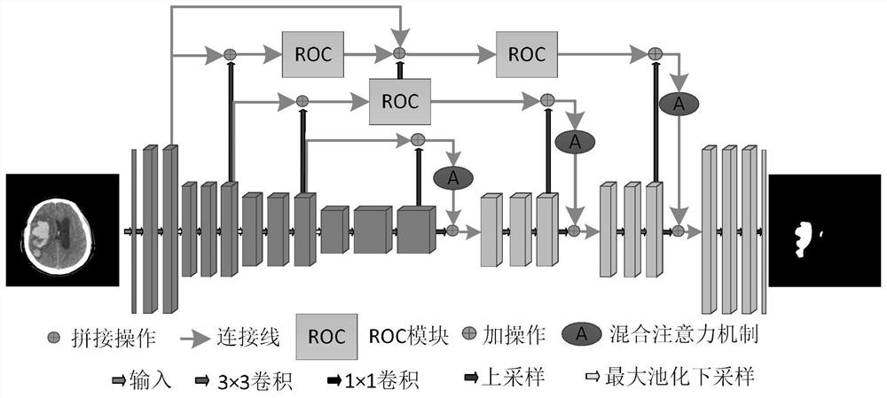 A CT image segmentation method based on improved au-net network