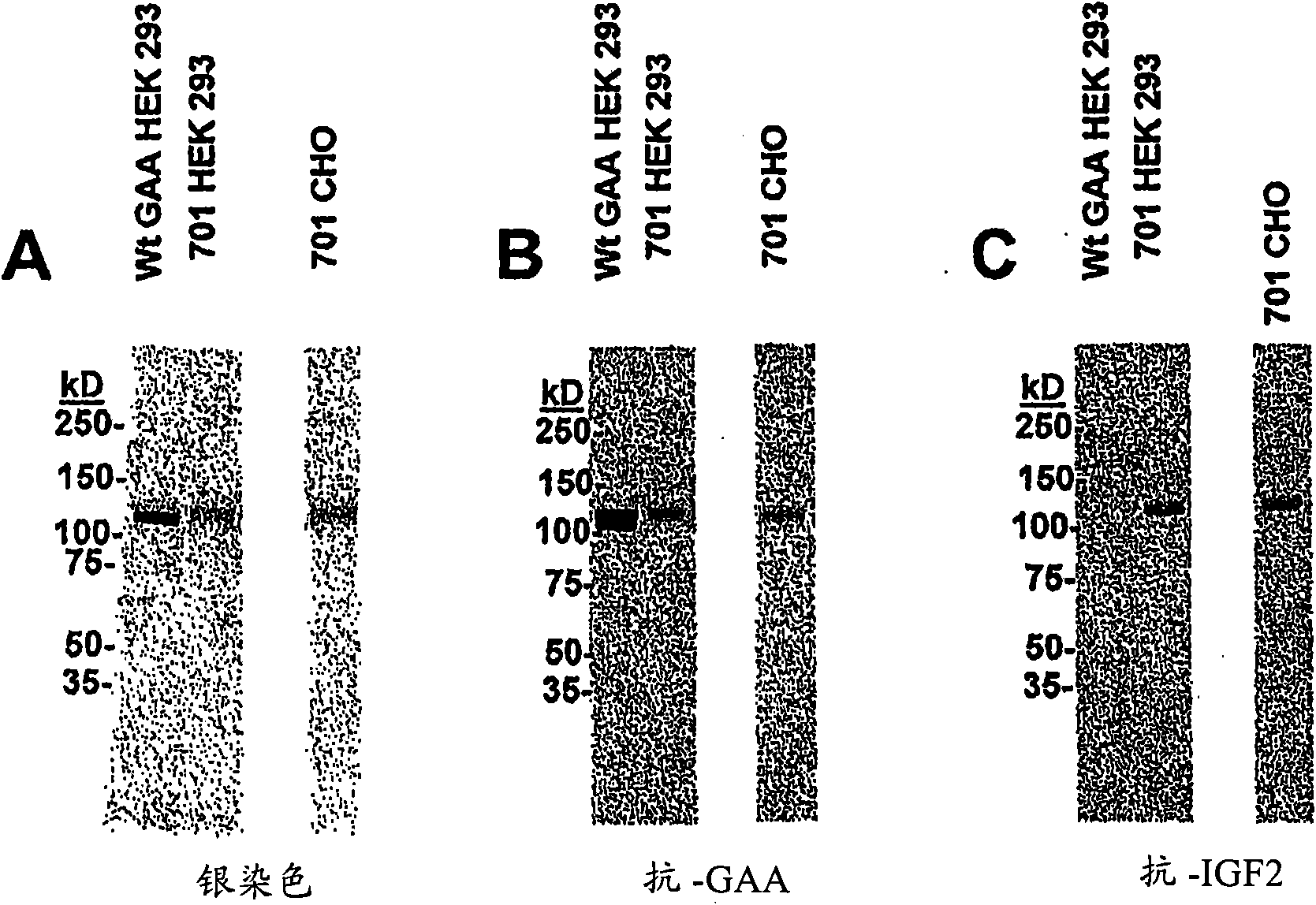 Methods for treating pompe disease