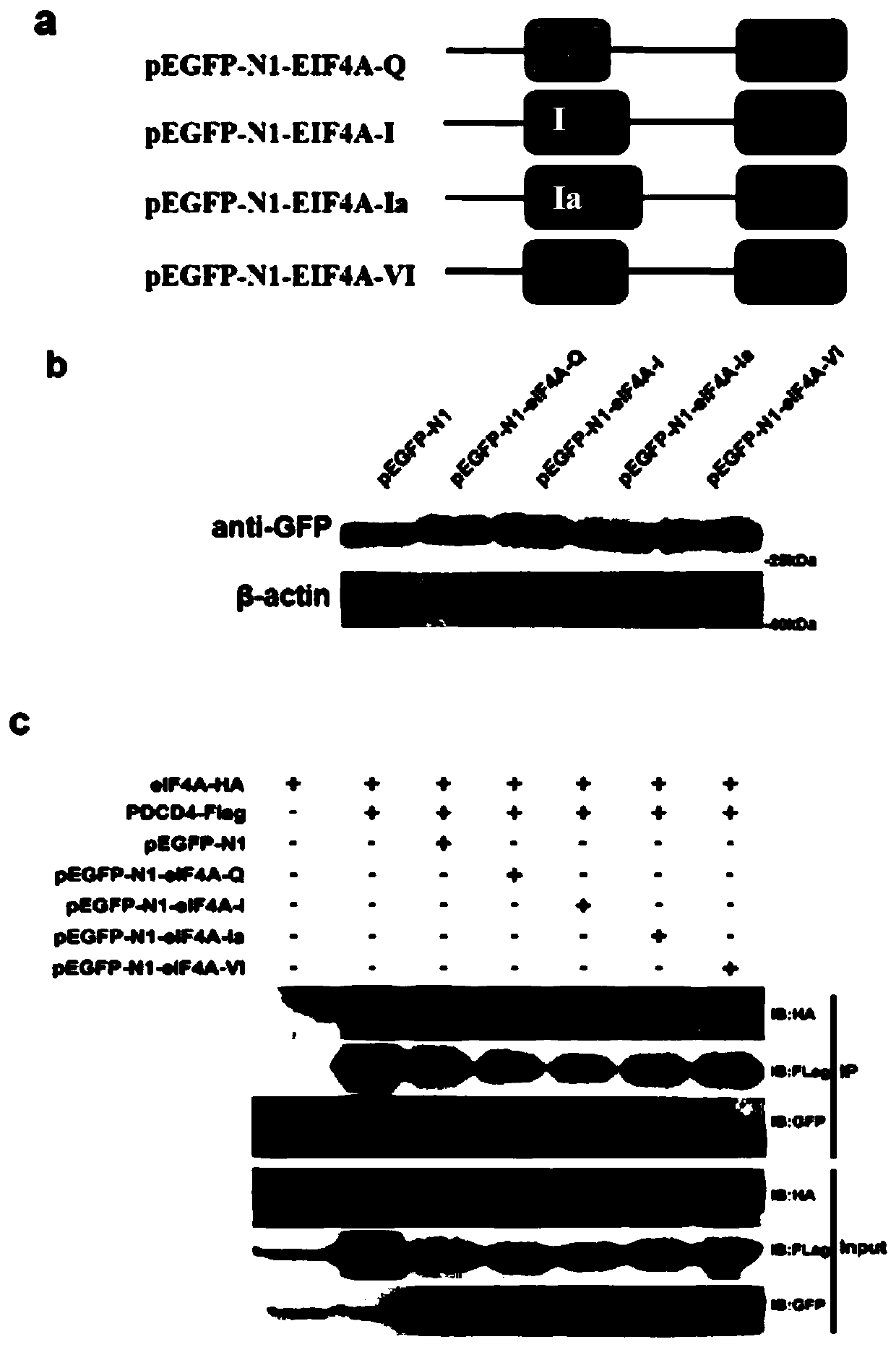 Fusion polypeptide and application of fusion polypeptide in preparing medicine for anti-depression and neurodegenerative disease