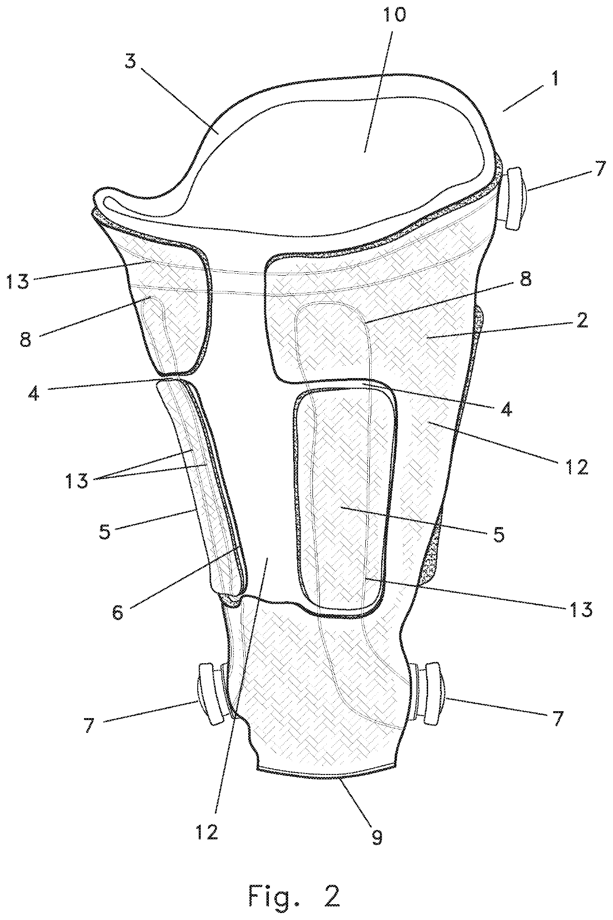 Disarticulated Compression Socket