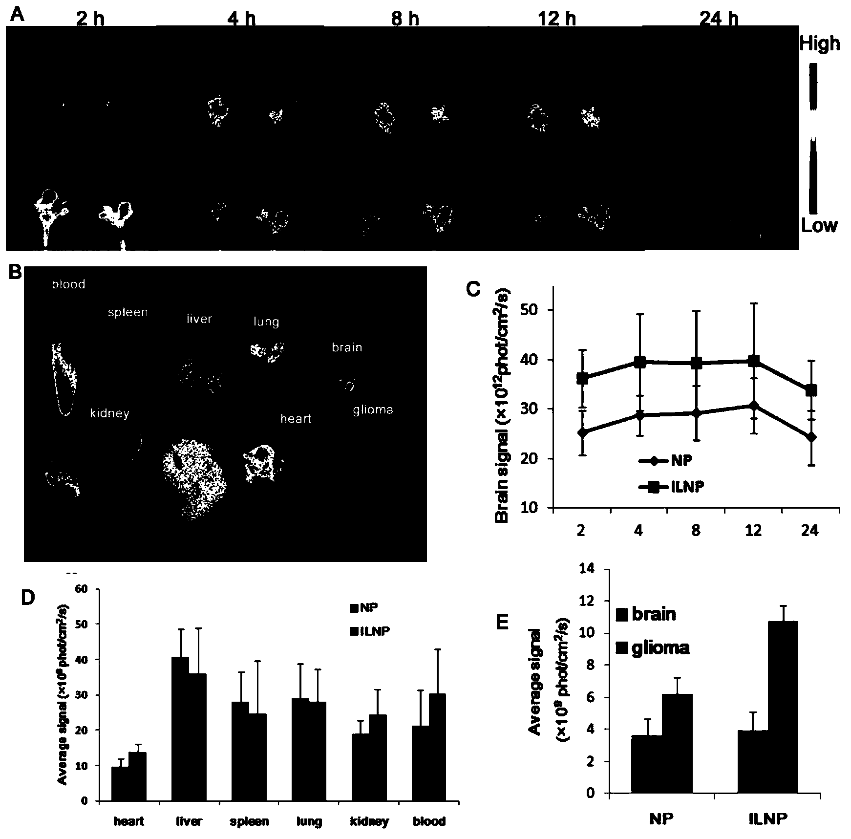 Targeting nanometer drug delivery system aiming at glioma