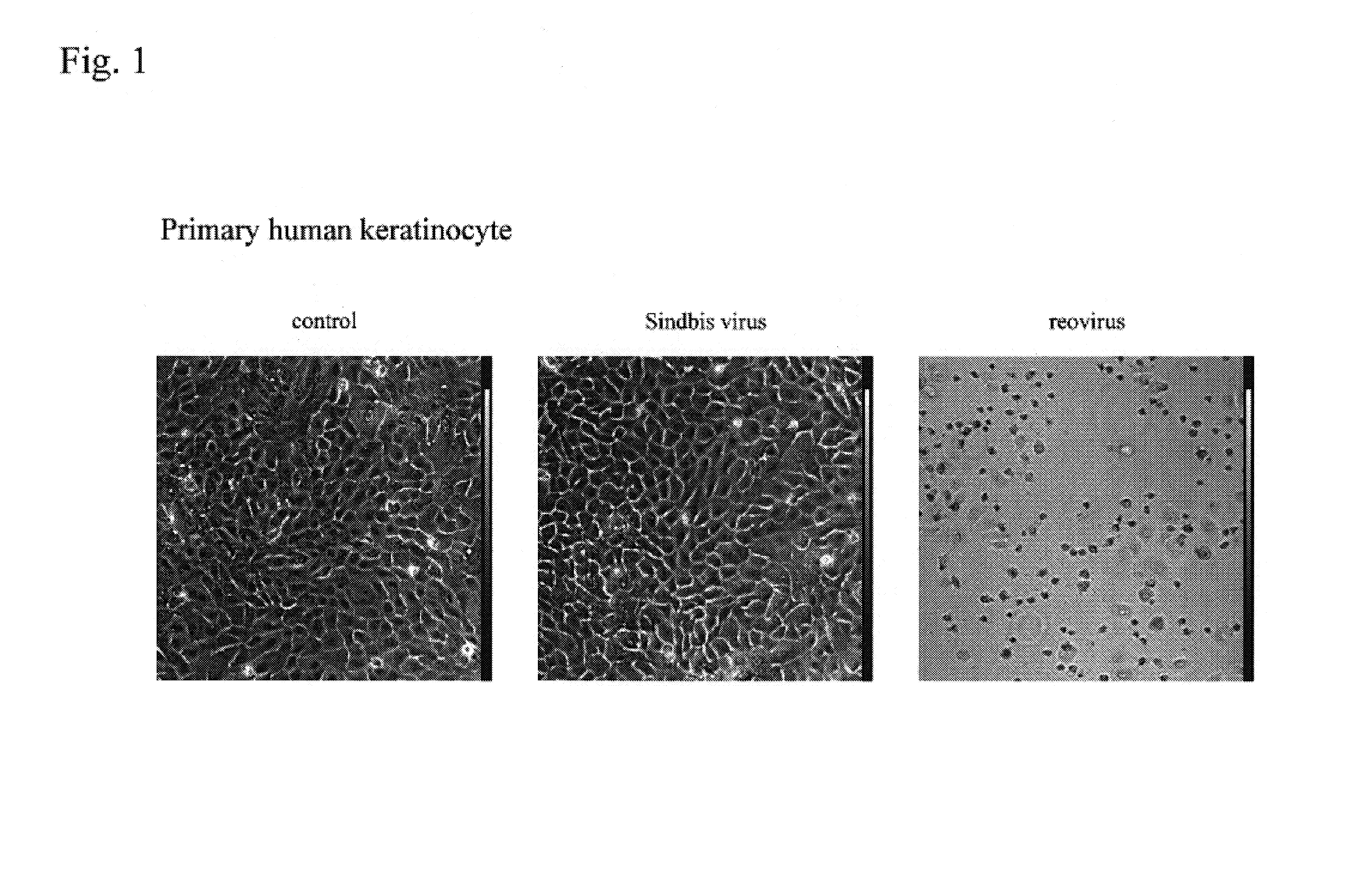 Pharmaceutical composition for treatment of cancers