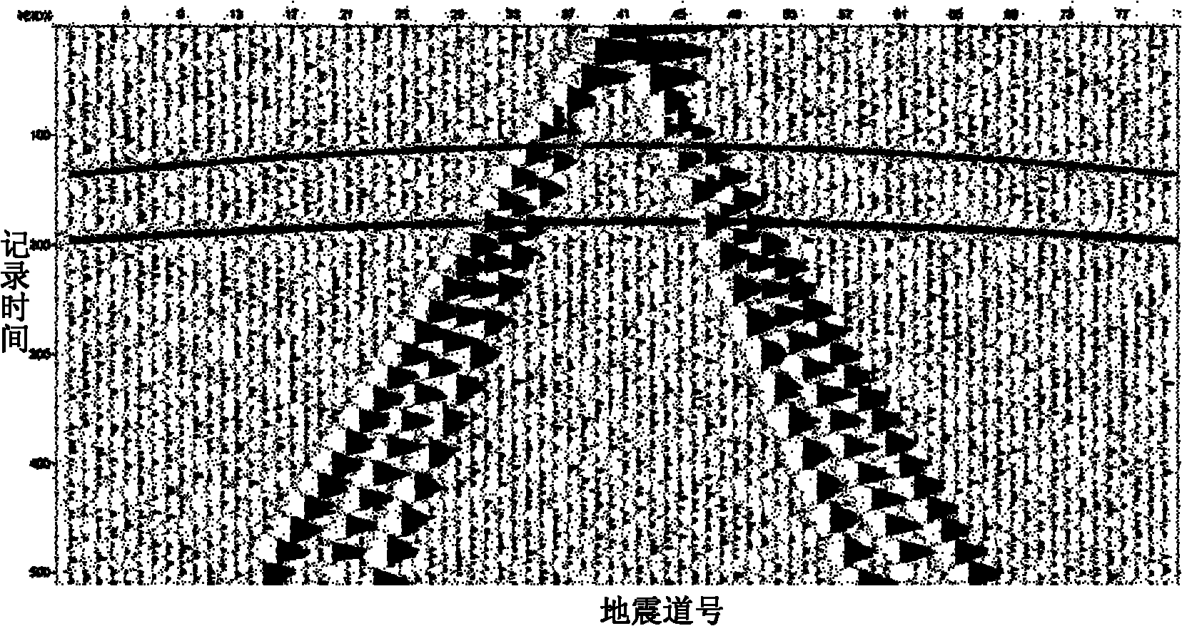 Method for suppressing interference of neutral line of prestack seismic signal based on curvelet transform