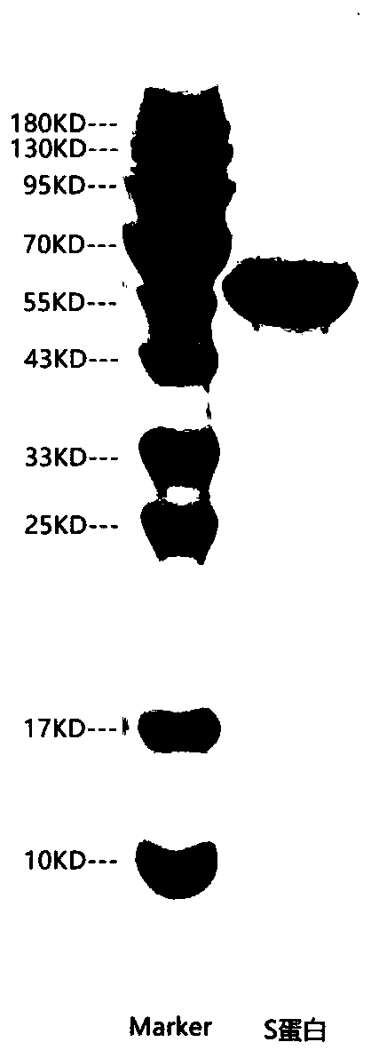 Immunochromatographic kit for detecting novel coronavirus SARS-CoV-2