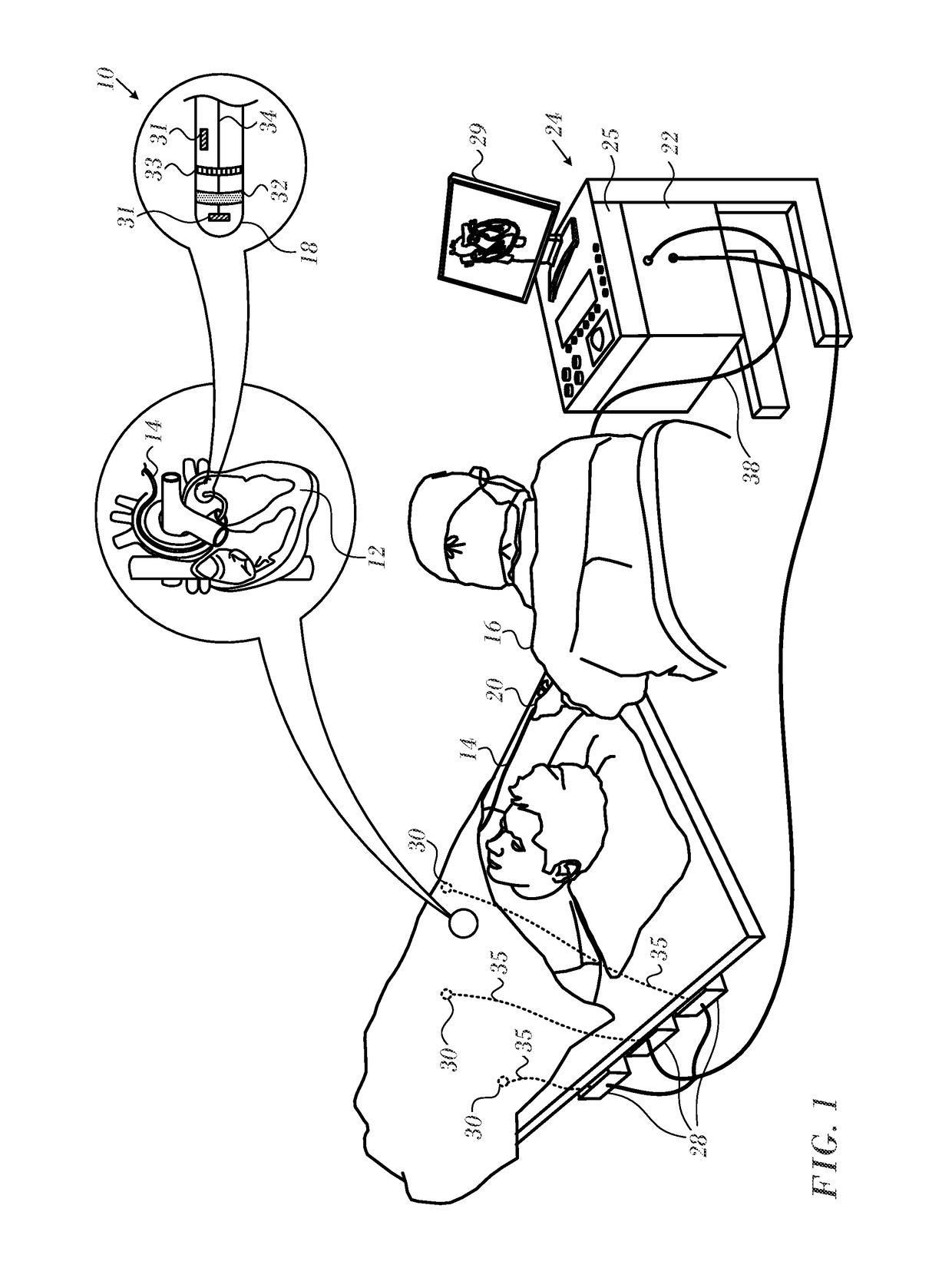 Ventricular electrical activity indicator