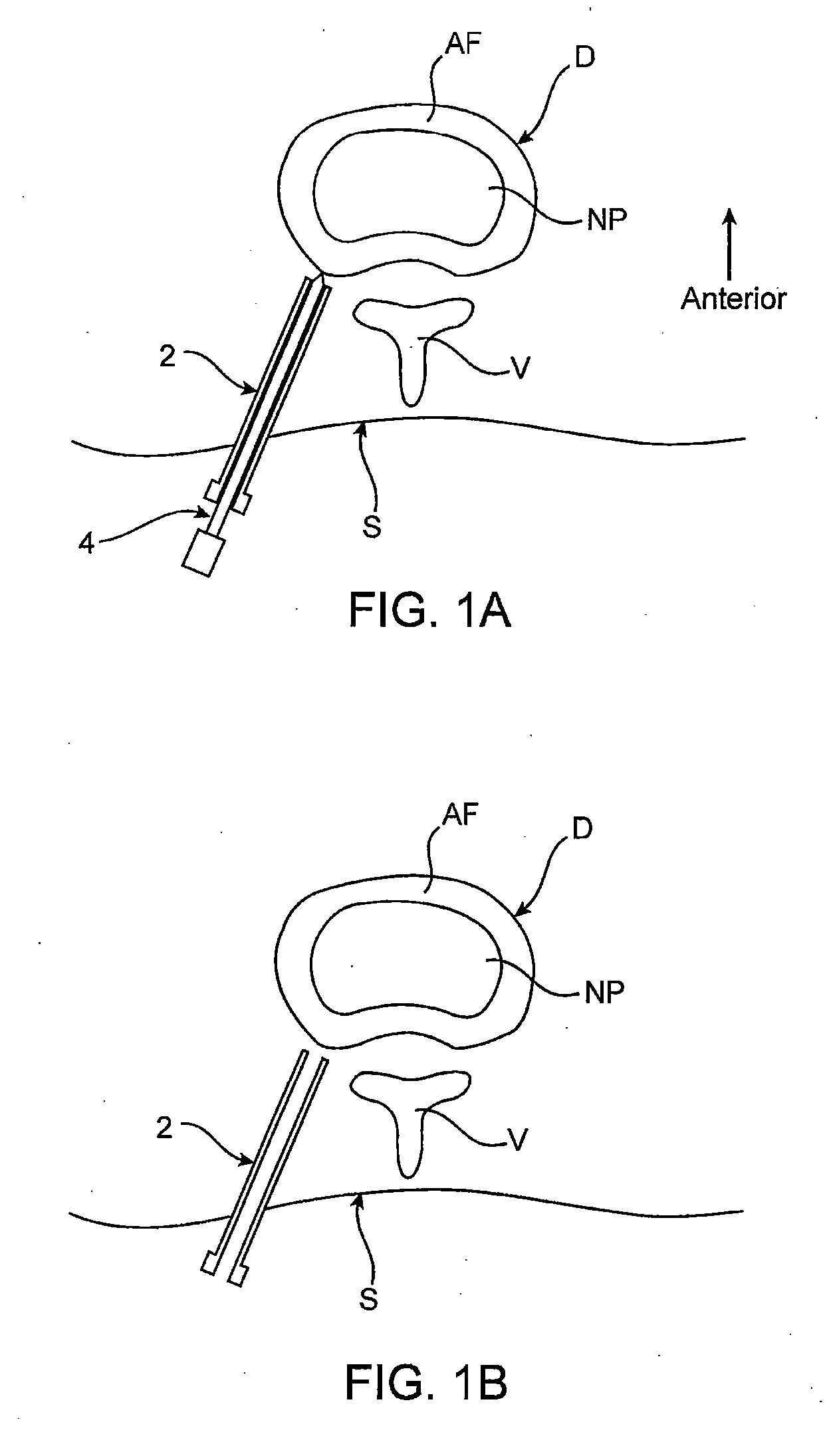 Spinal diagnostic methods and apparatus