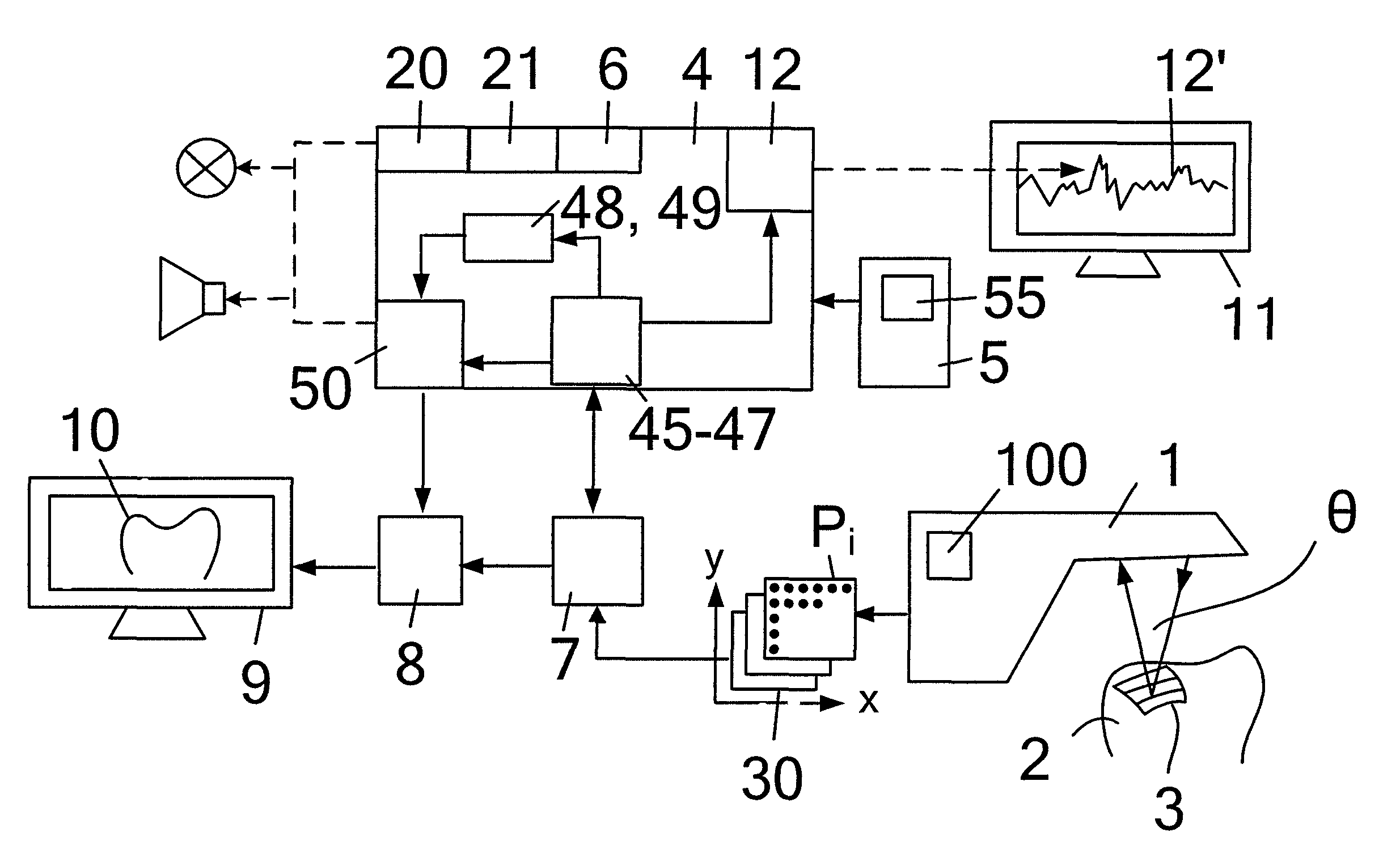 Method and device for optical scanning of three-dimensional objects by means of a dental 3D camera using a triangulation method