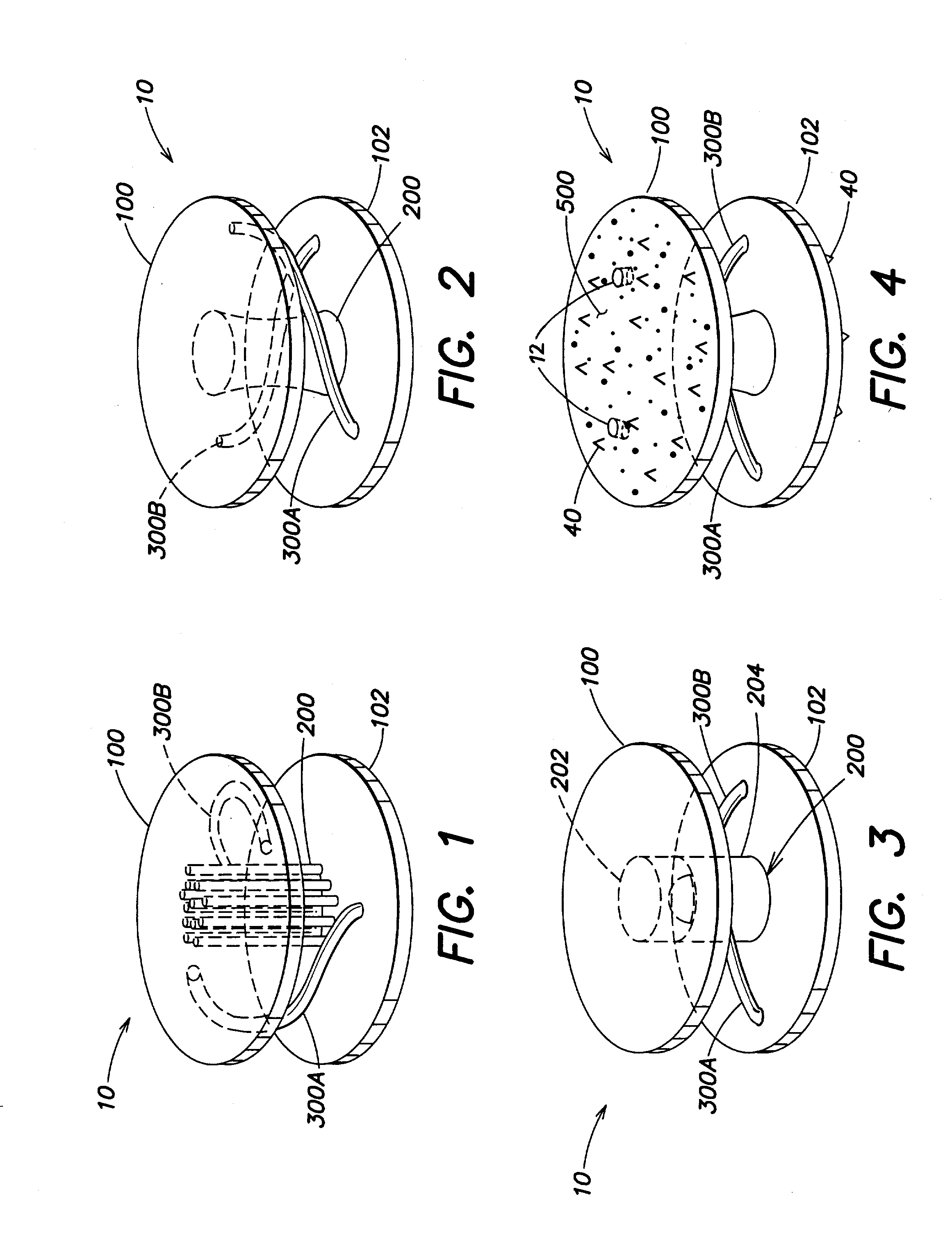 Orthopedic implant