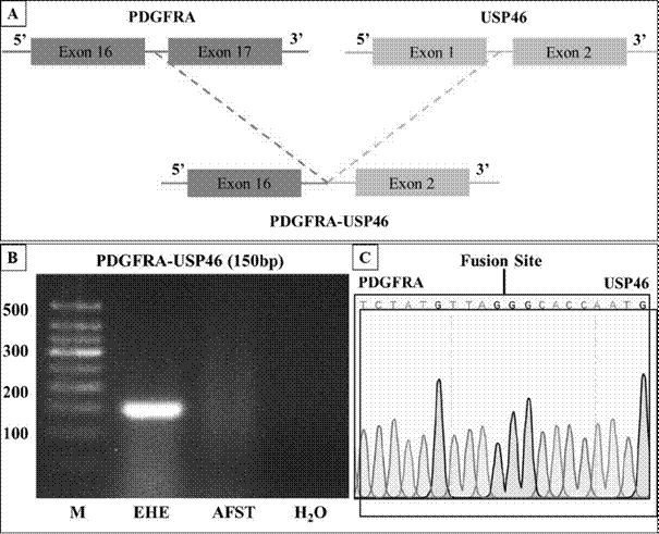 Molecular marker for epithelioid vascular endothelial tumor and detection kit thereof