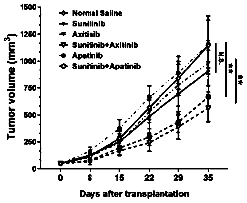 Pharmaceutical composition containing sunitinib as well as preparation and application of pharmaceutical composition