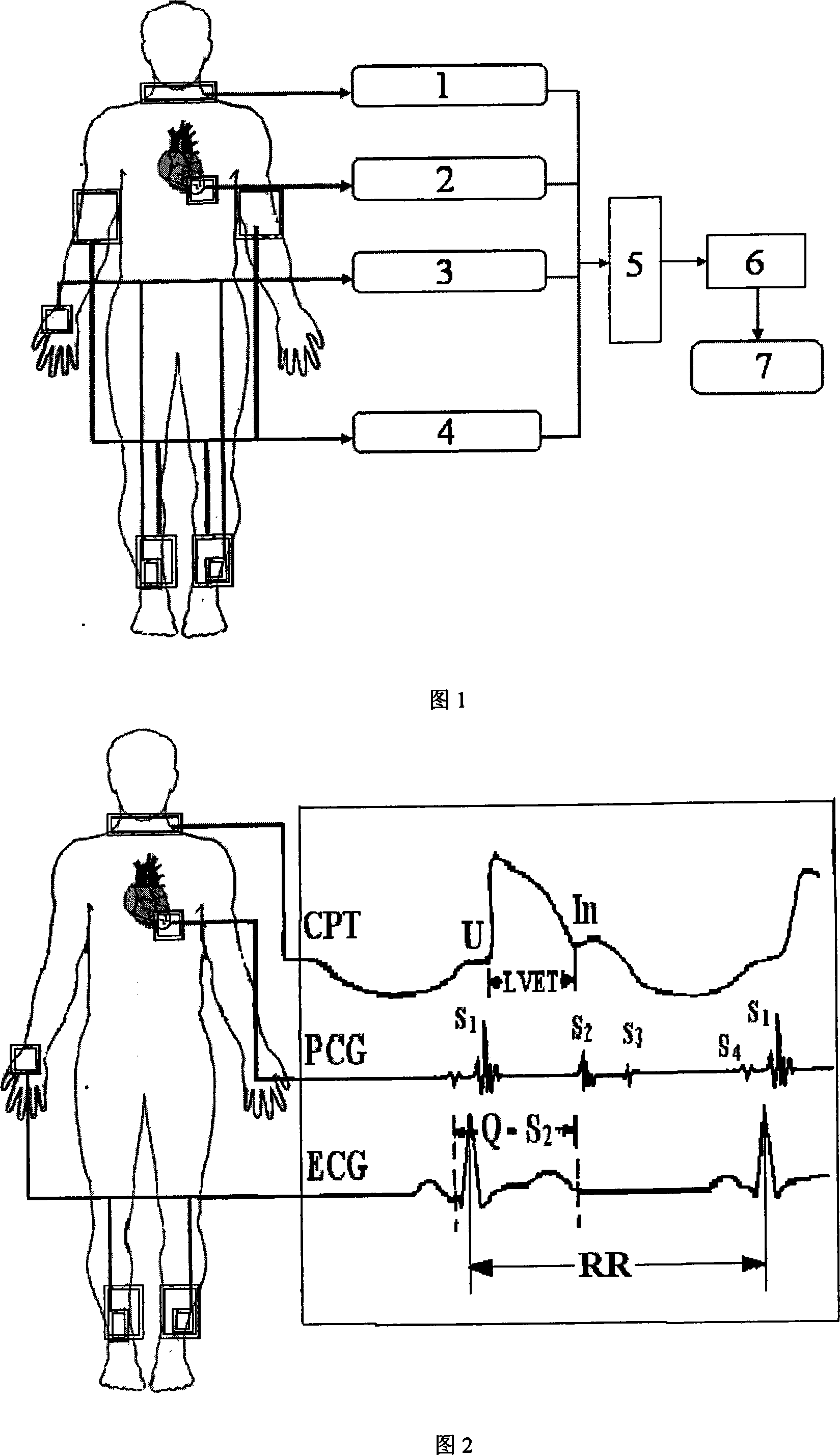 Method and apparatus for detecting systema cariovasculare functional state