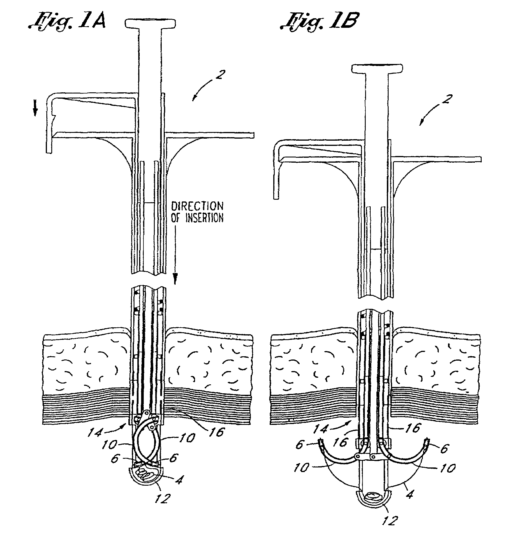 Suturing instruments and methods of use