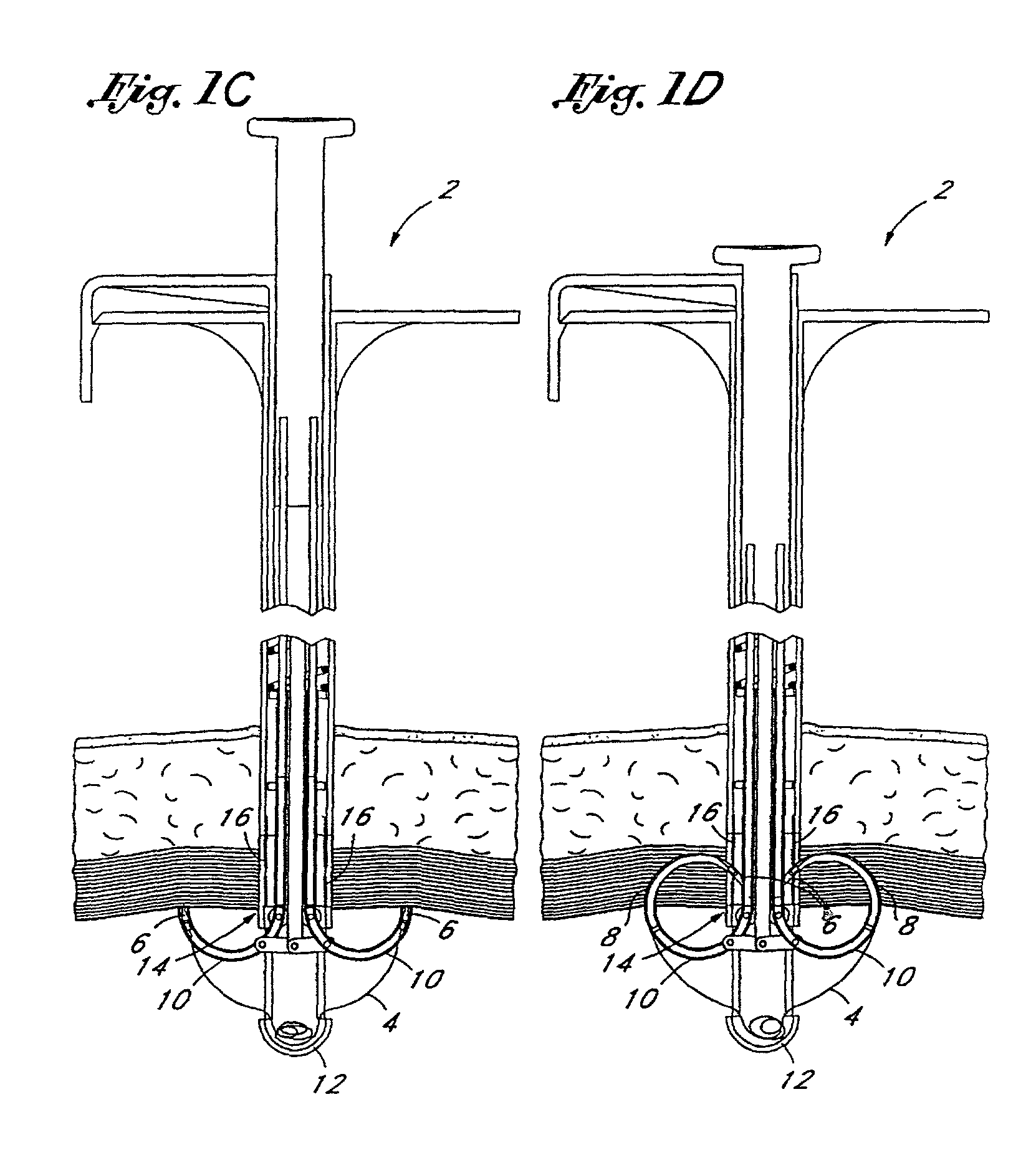 Suturing instruments and methods of use