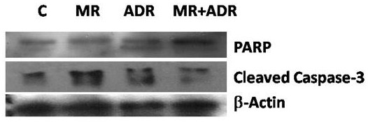 Application of Myricetin in Preparation of Anti-Adriamycin Cardiotoxicity Protection Preparation