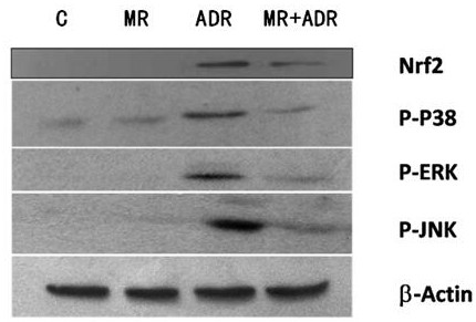 Application of Myricetin in Preparation of Anti-Adriamycin Cardiotoxicity Protection Preparation