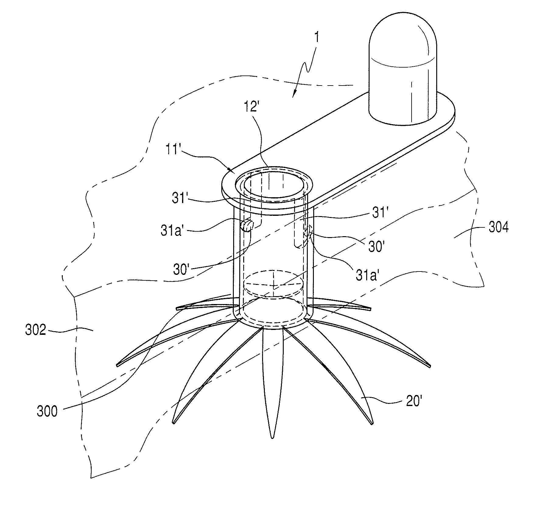 Retention device for gastrostomy tube and low profile gastrostomy device