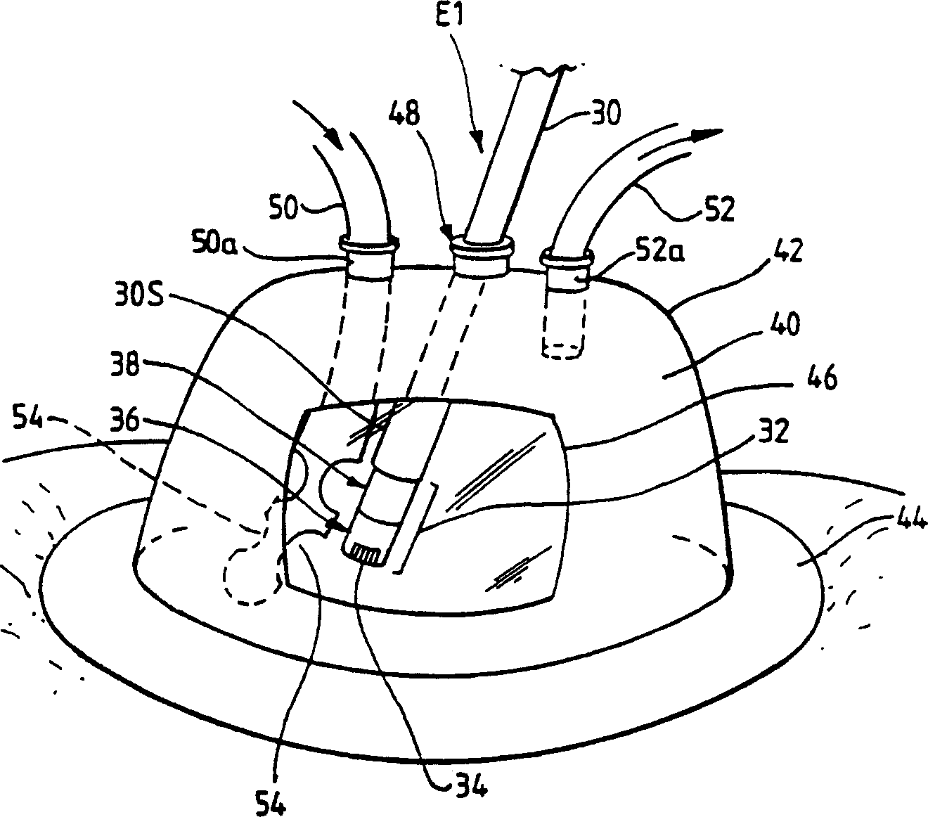 Electrosurgical system