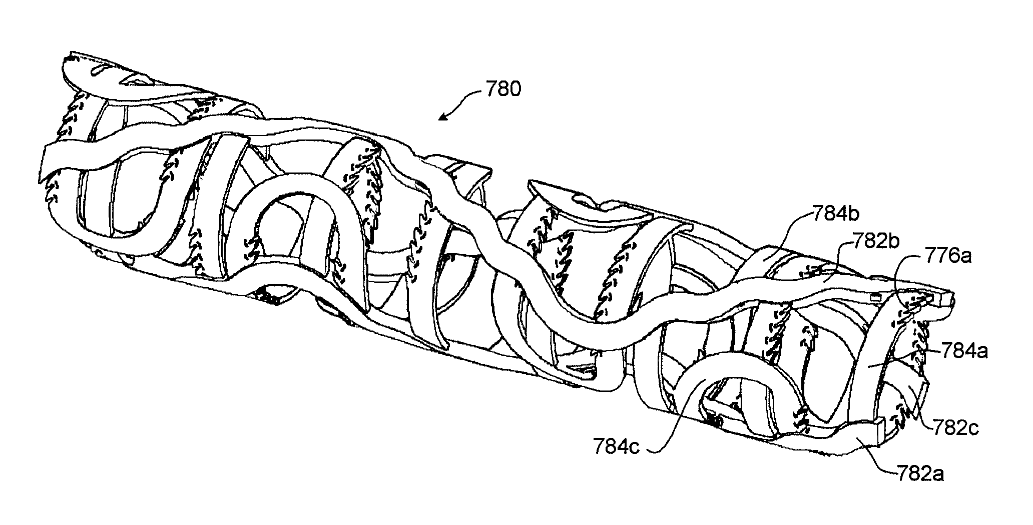 Expandable slide and lock stent