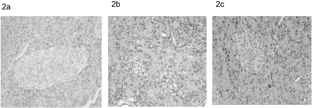 Construction method of polycystic ovarian syndrome with type 2 diabetes mellitus rat model