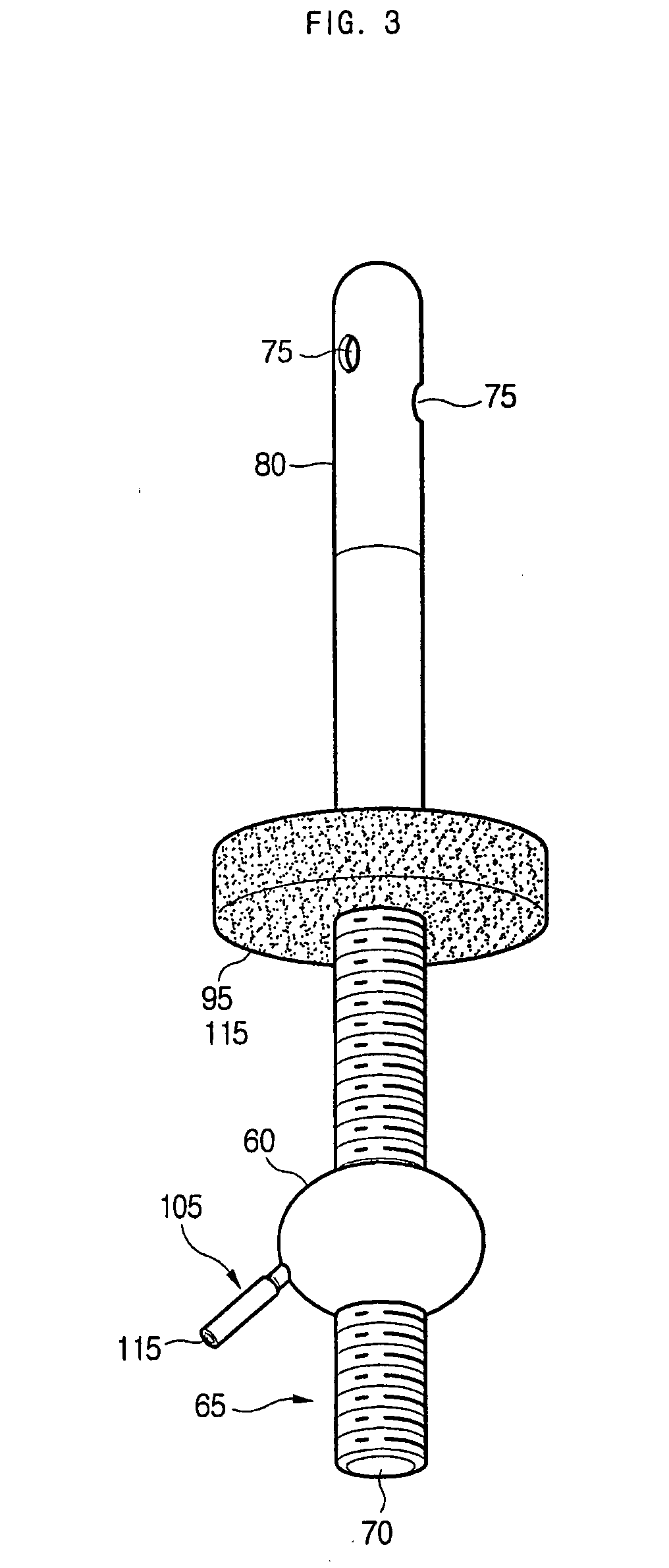 Indwelling urinary catheter