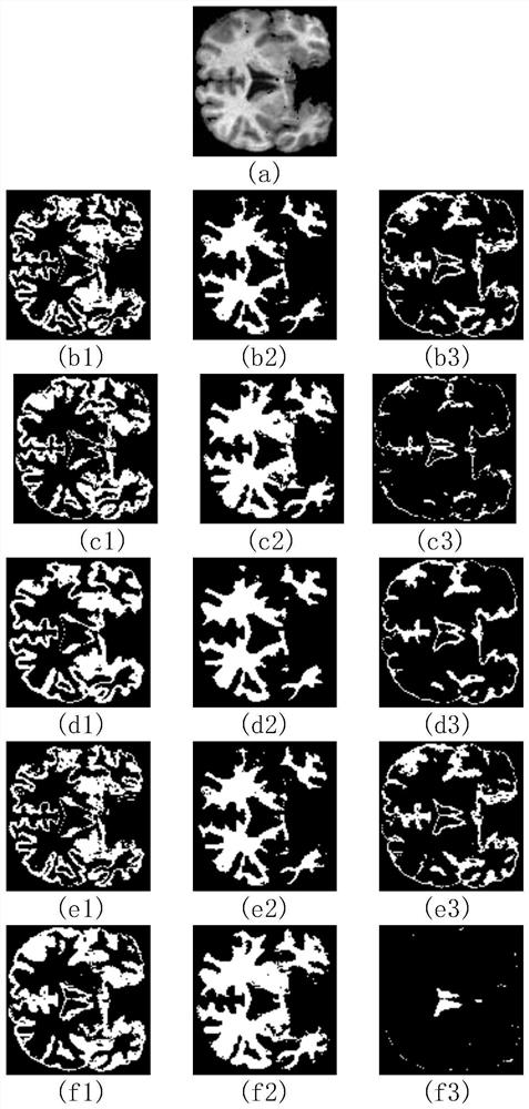 Brain magnetic resonance image segmentation method based on improved fuzzy C-means