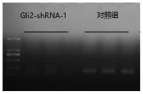 GLI2-shRNA and application thereof