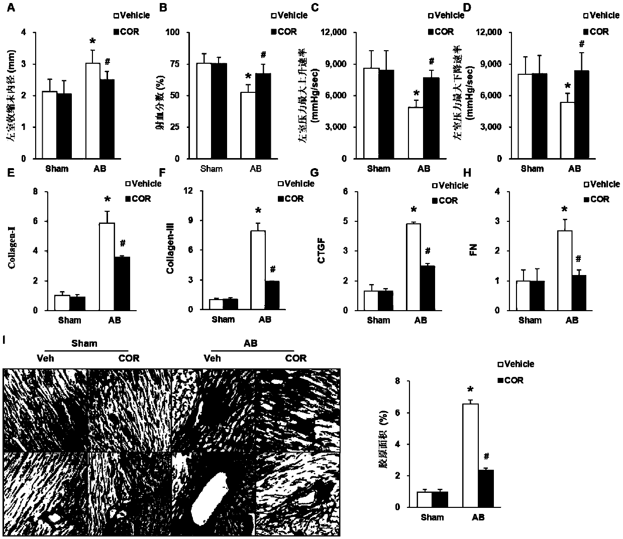 Use of corilagin in preparation of anti-myocardial fibrosis medicines