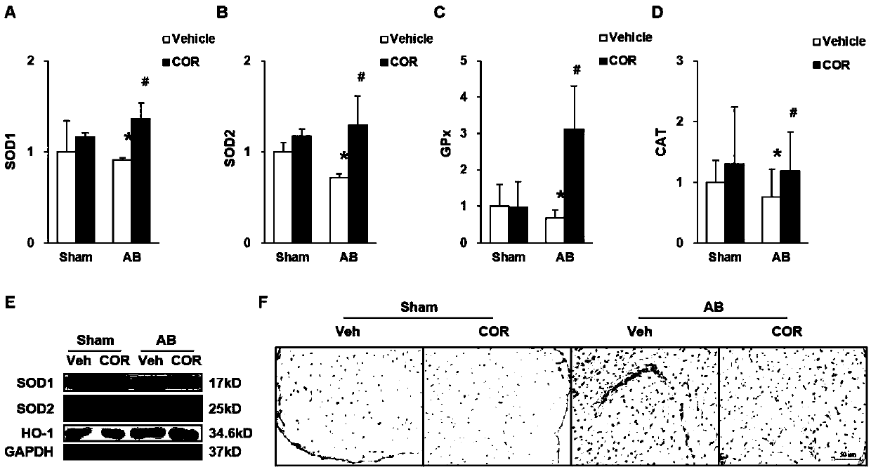 Use of corilagin in preparation of anti-myocardial fibrosis medicines